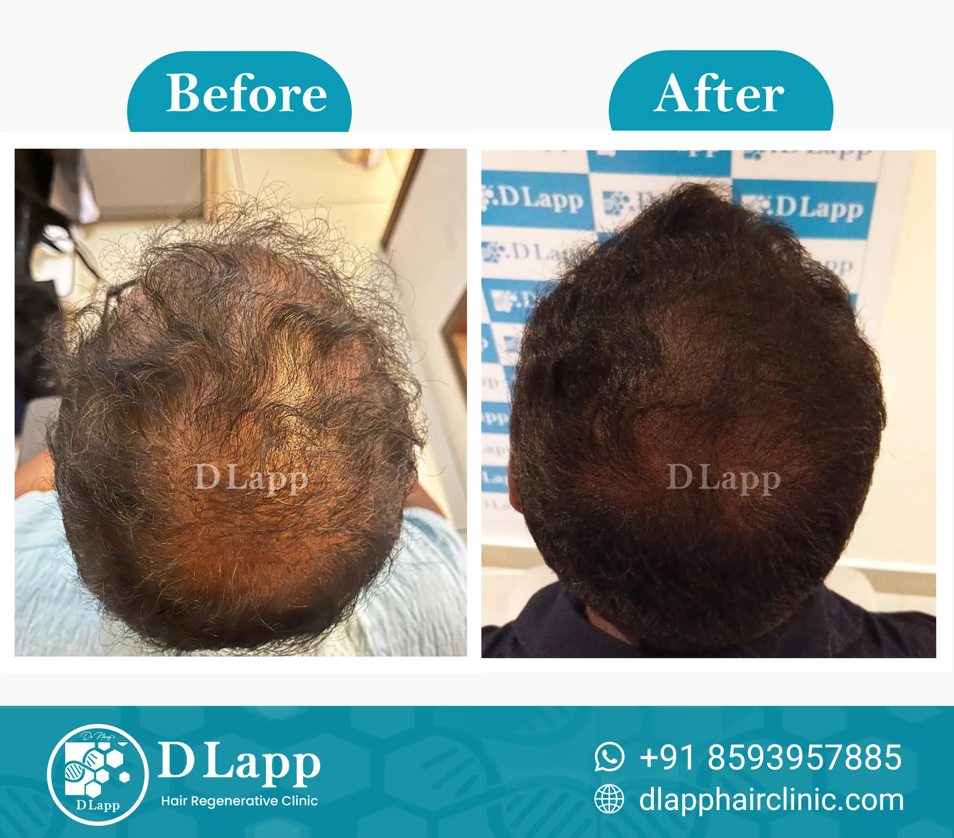 Before/After Medical Image