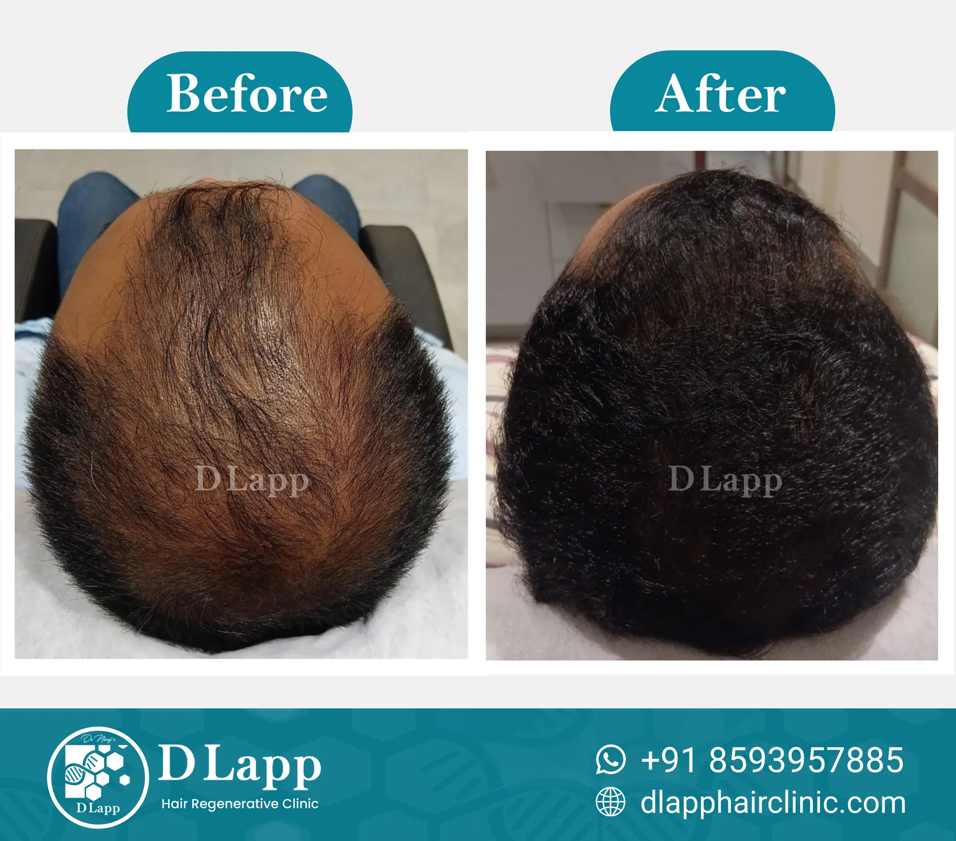 Before/After Medical Image