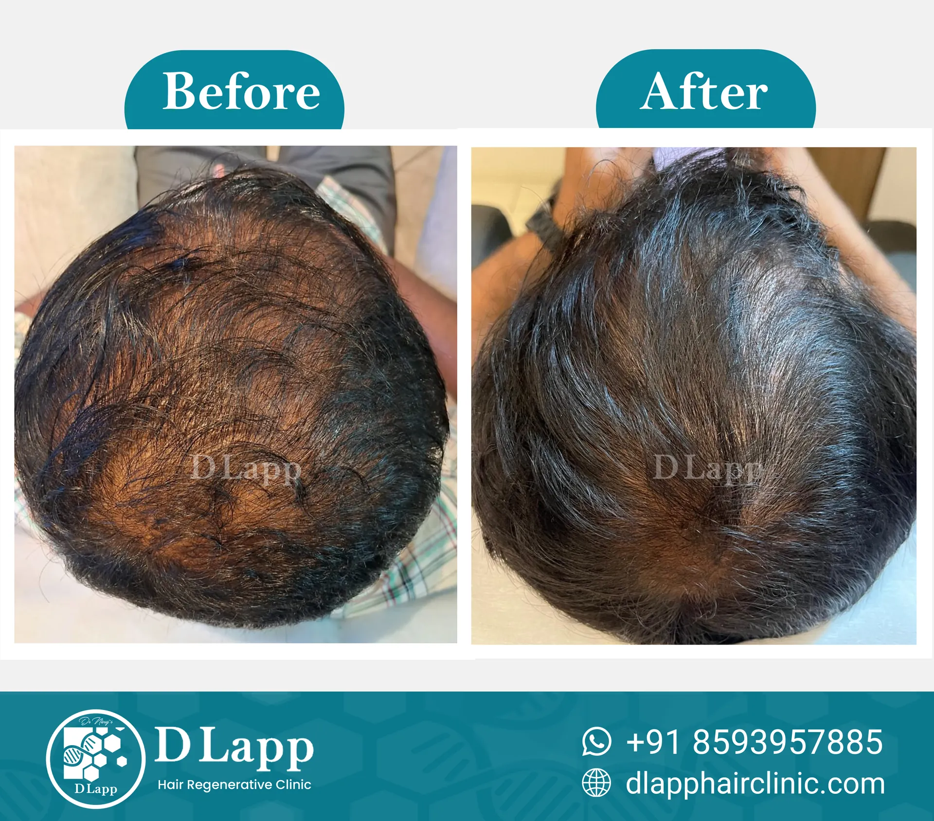 Before/After Medical Image