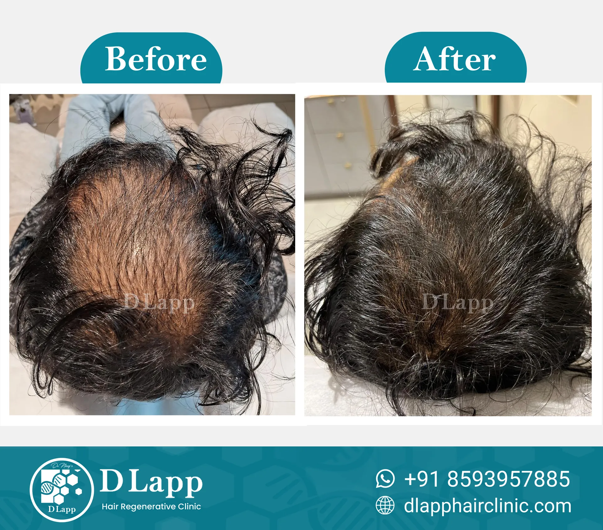 Before/After Medical Image