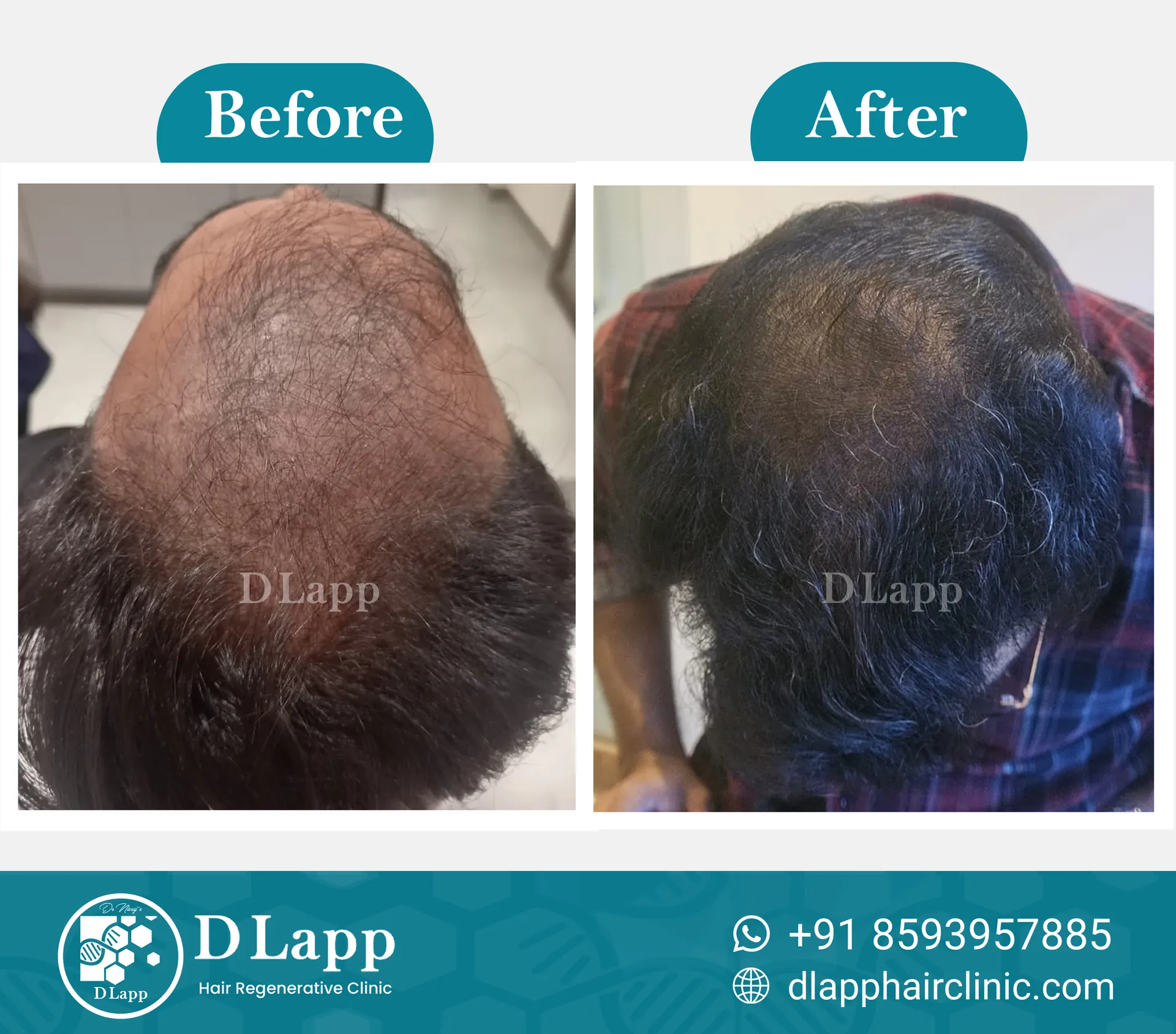 Before/After Medical Image