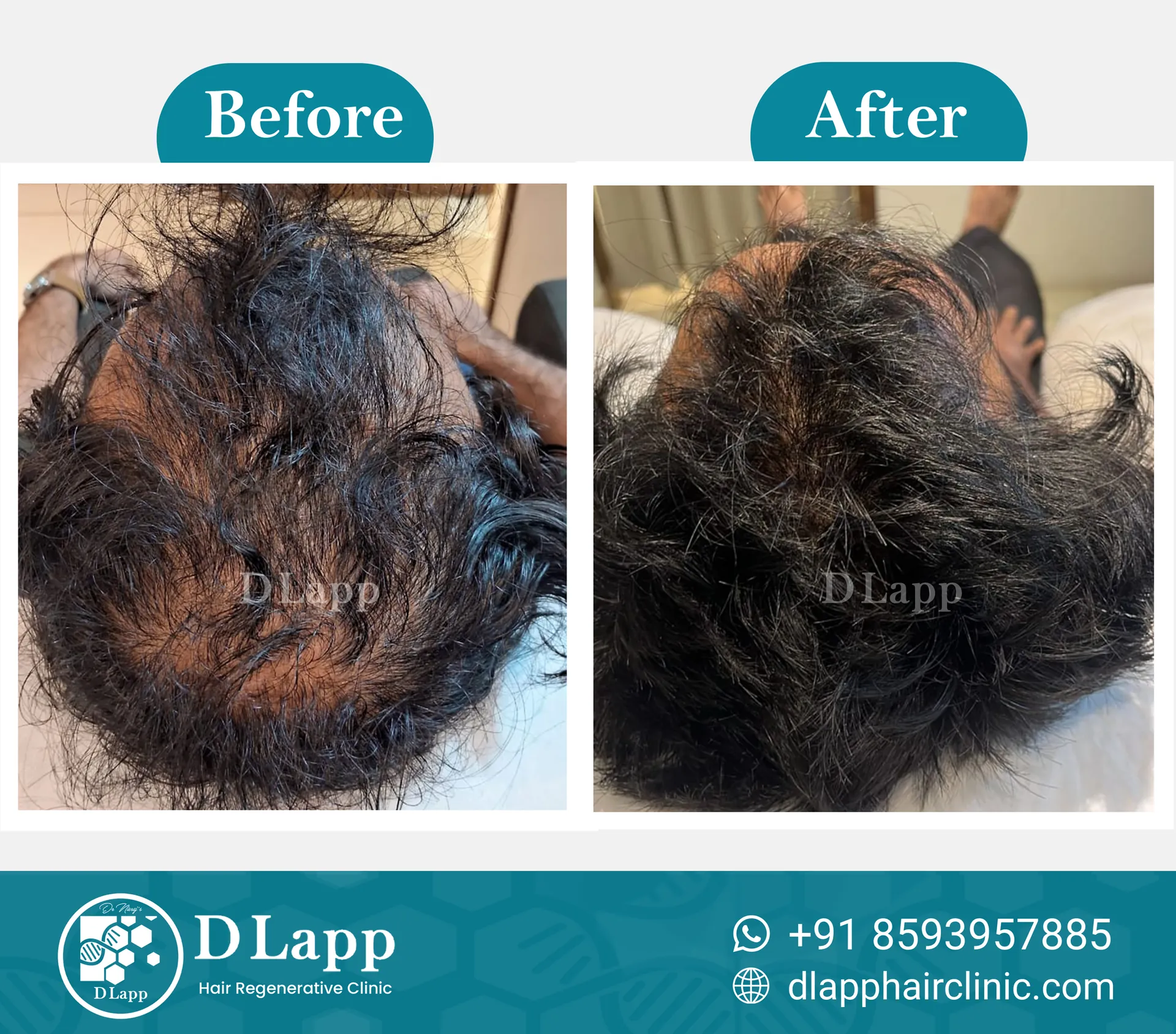 Before/After Medical Image
