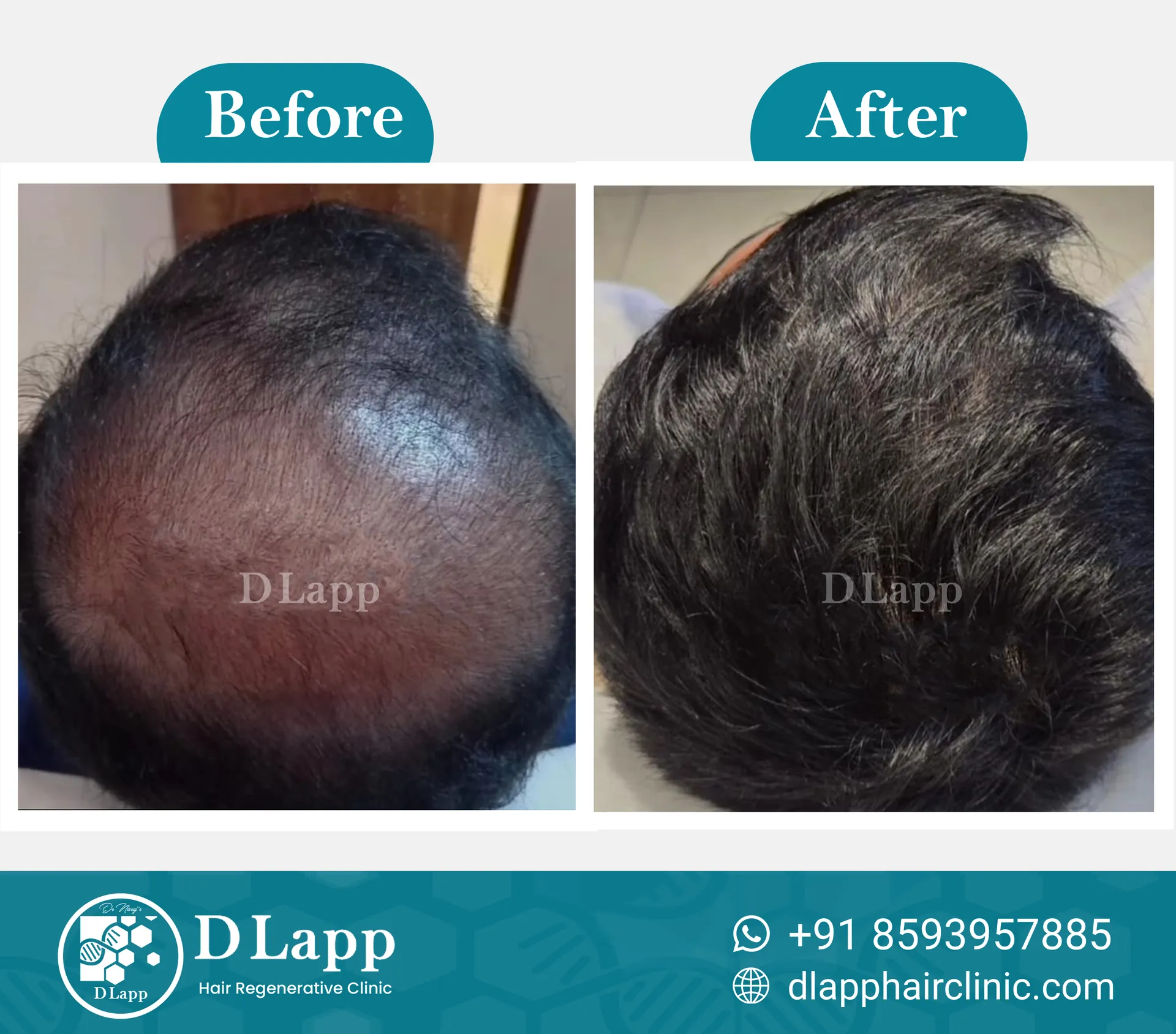 Before/After Medical Image