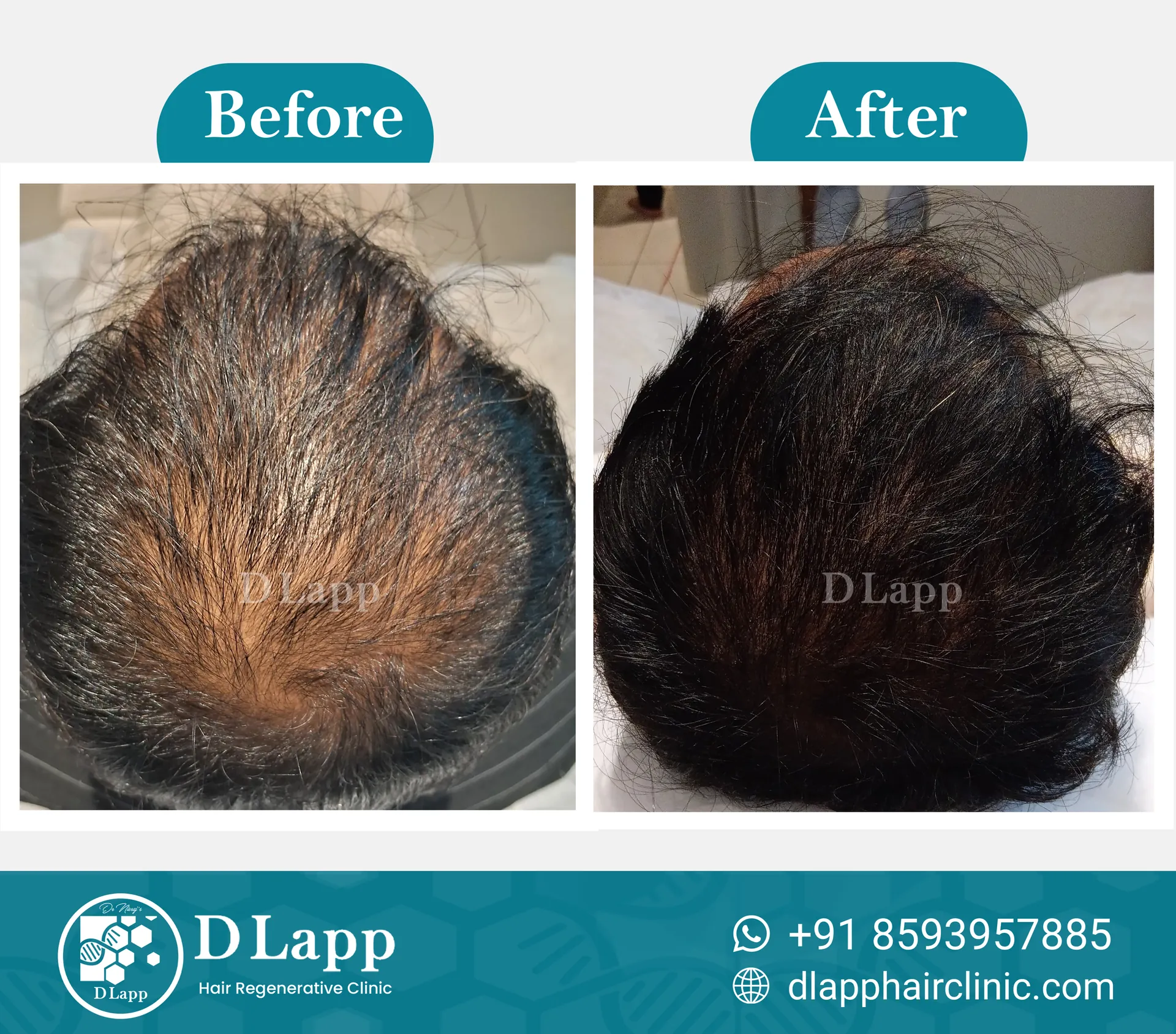 Before/After Medical Image
