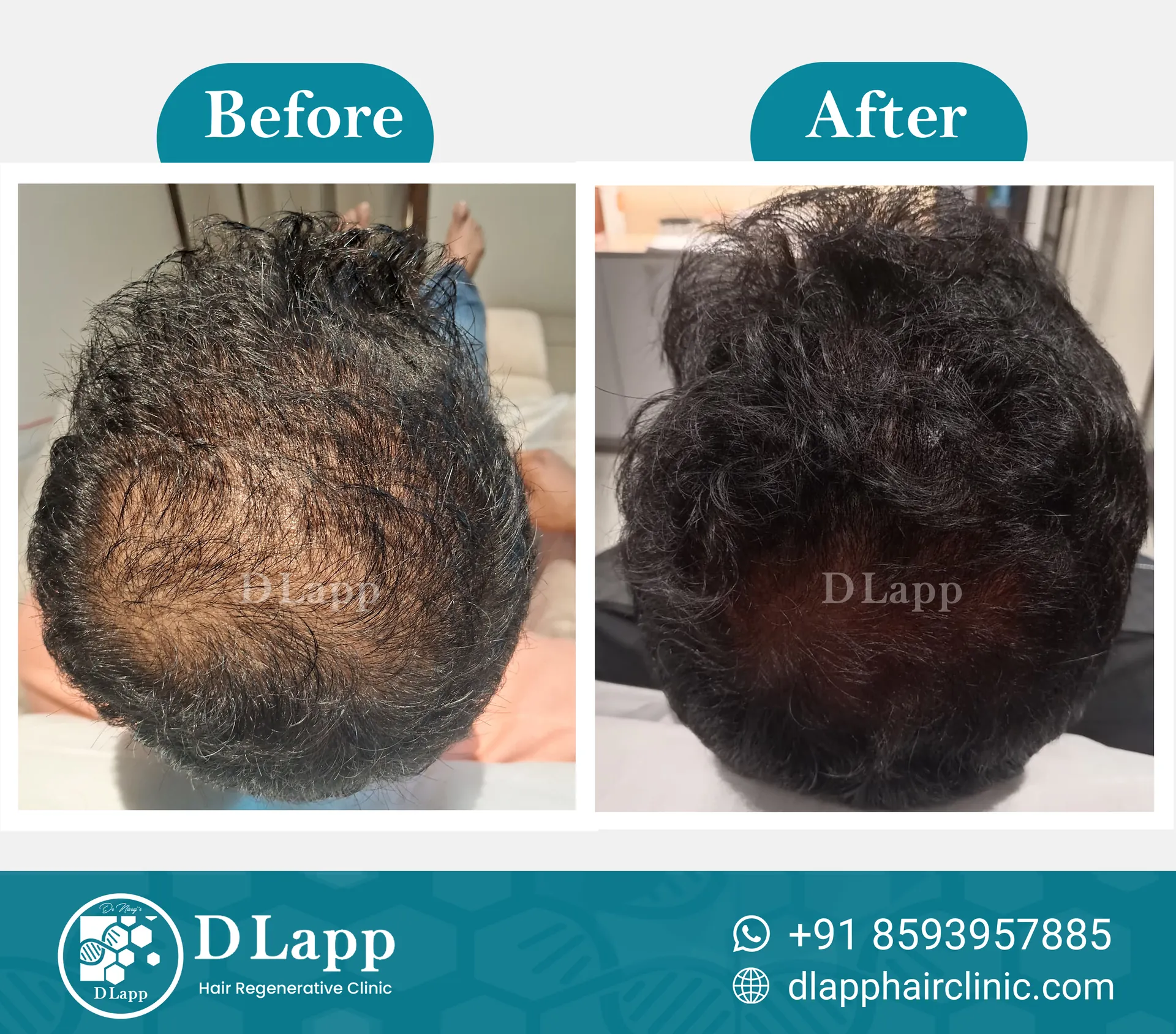 Before/After Medical Image