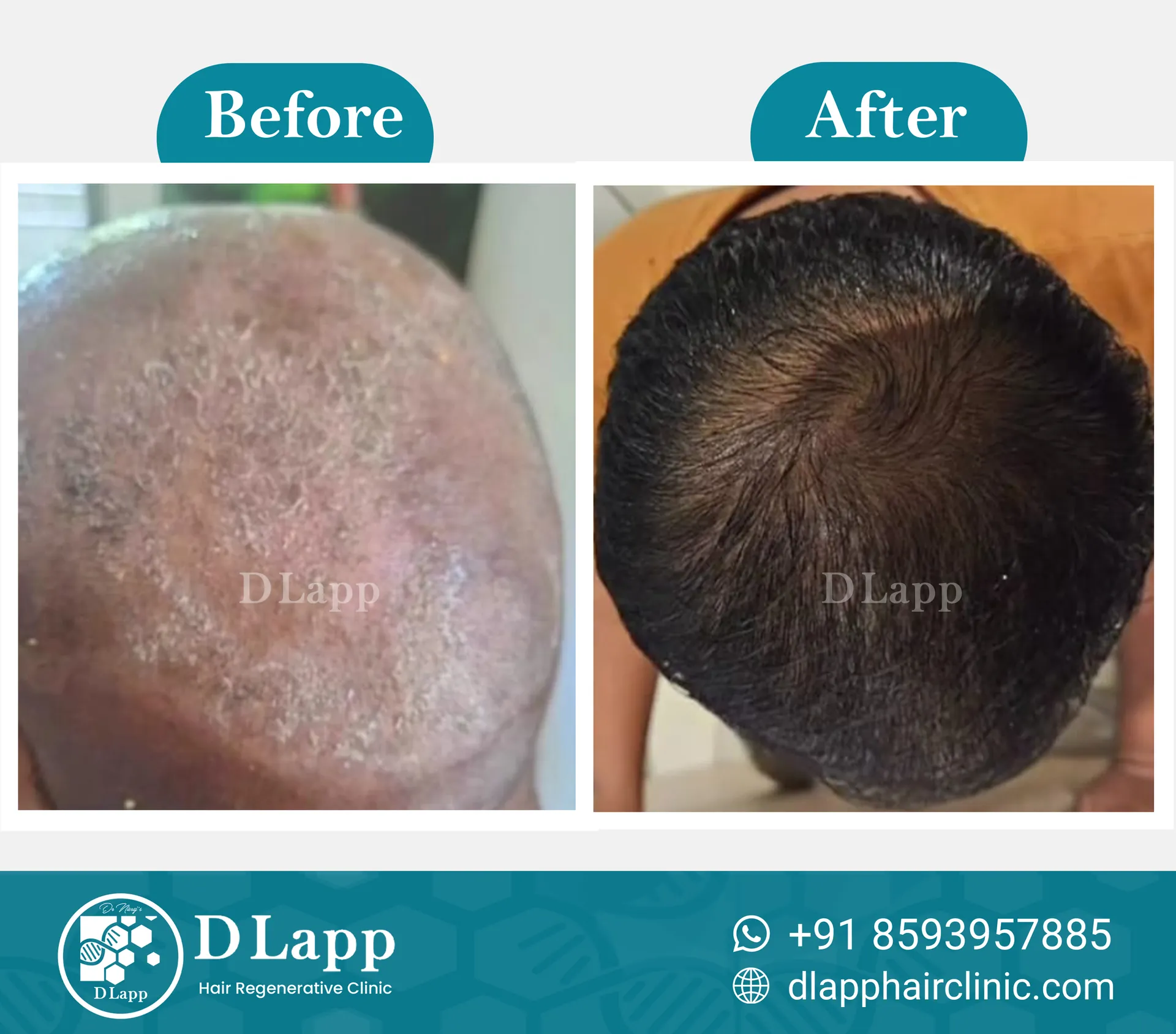 Before/After Medical Image