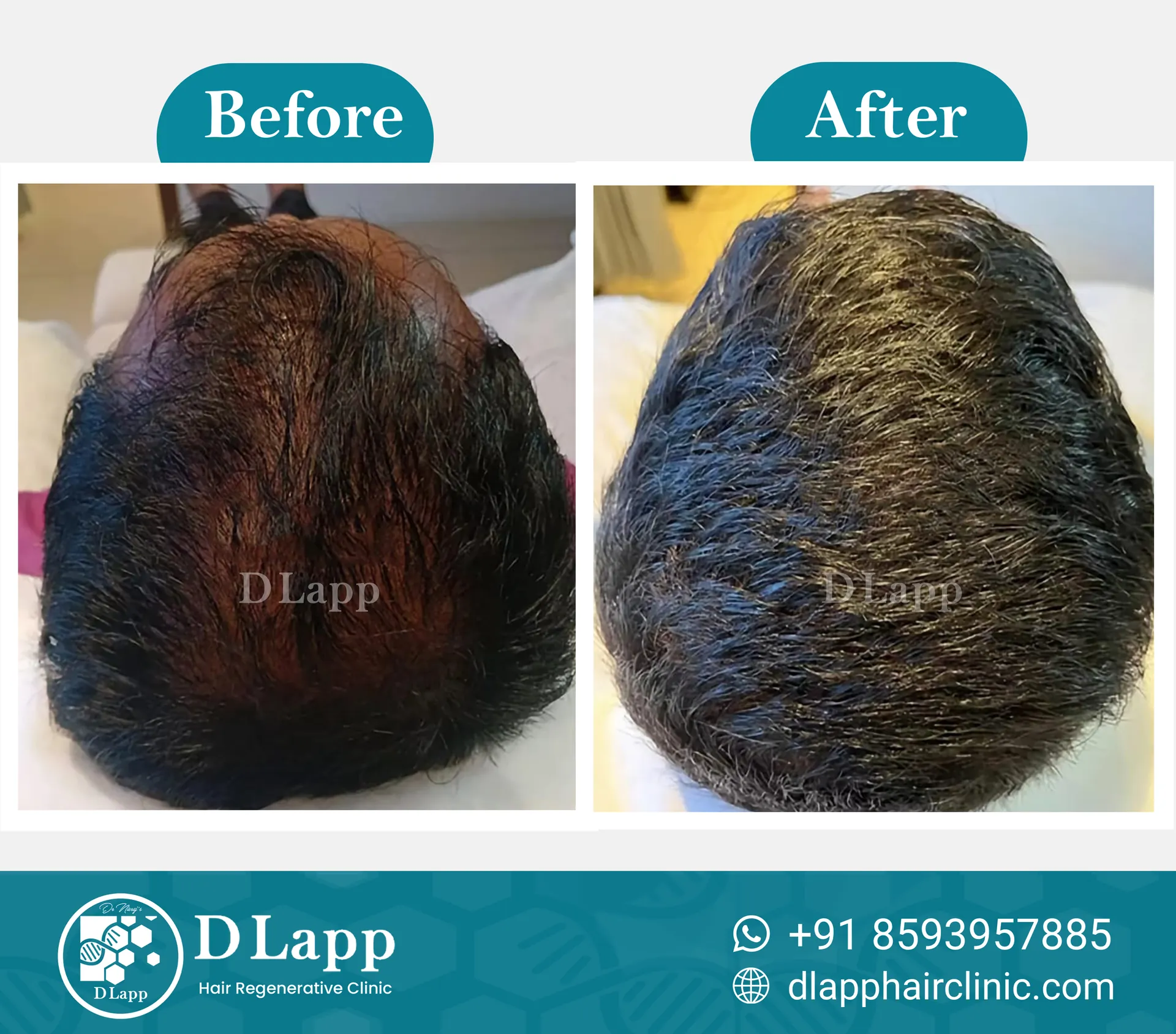Before/After Medical Image