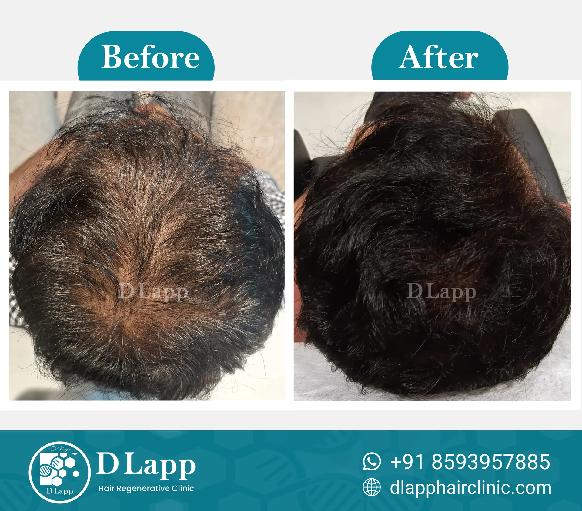 Before/After Medical Image