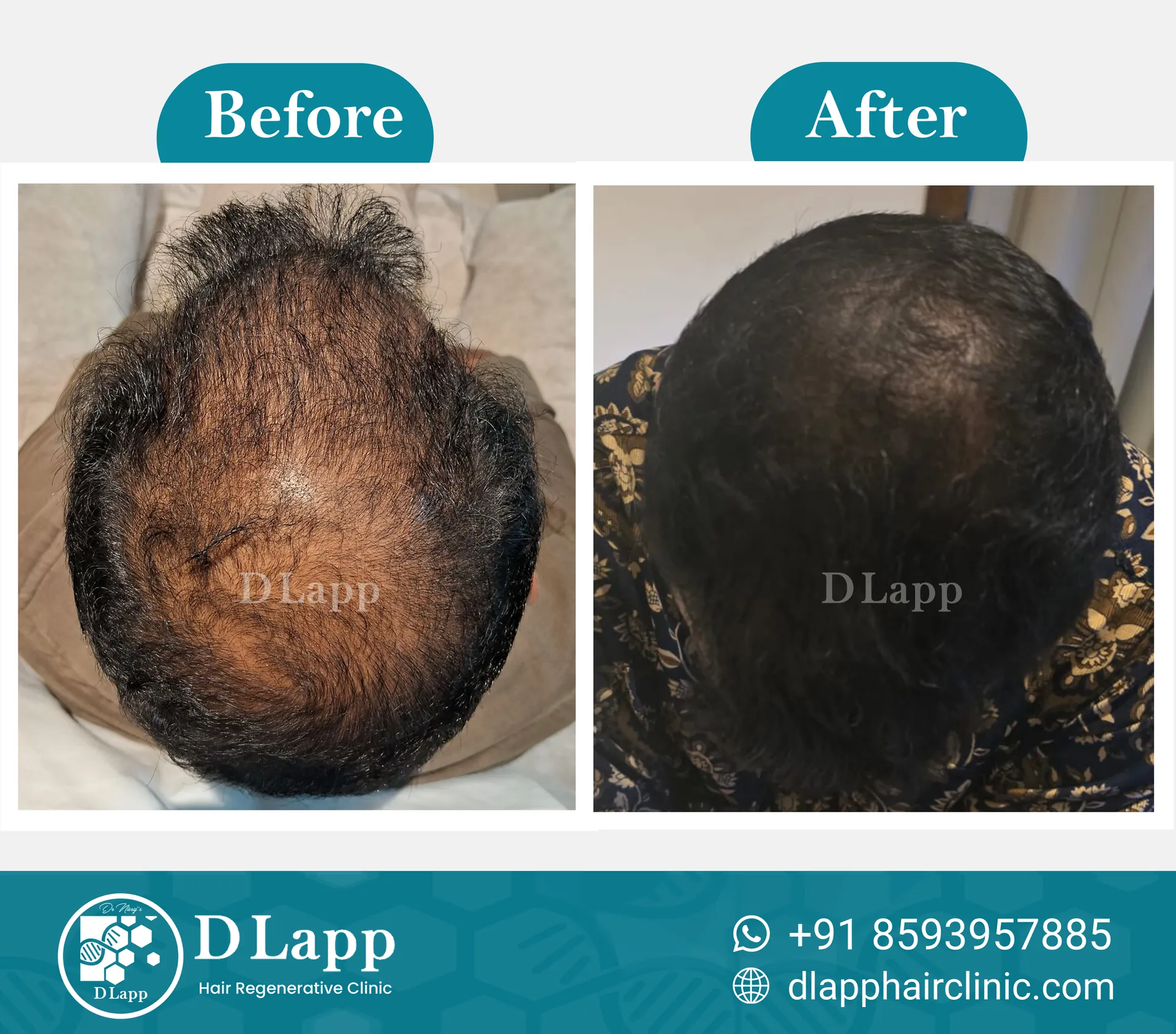 Before/After Medical Image
