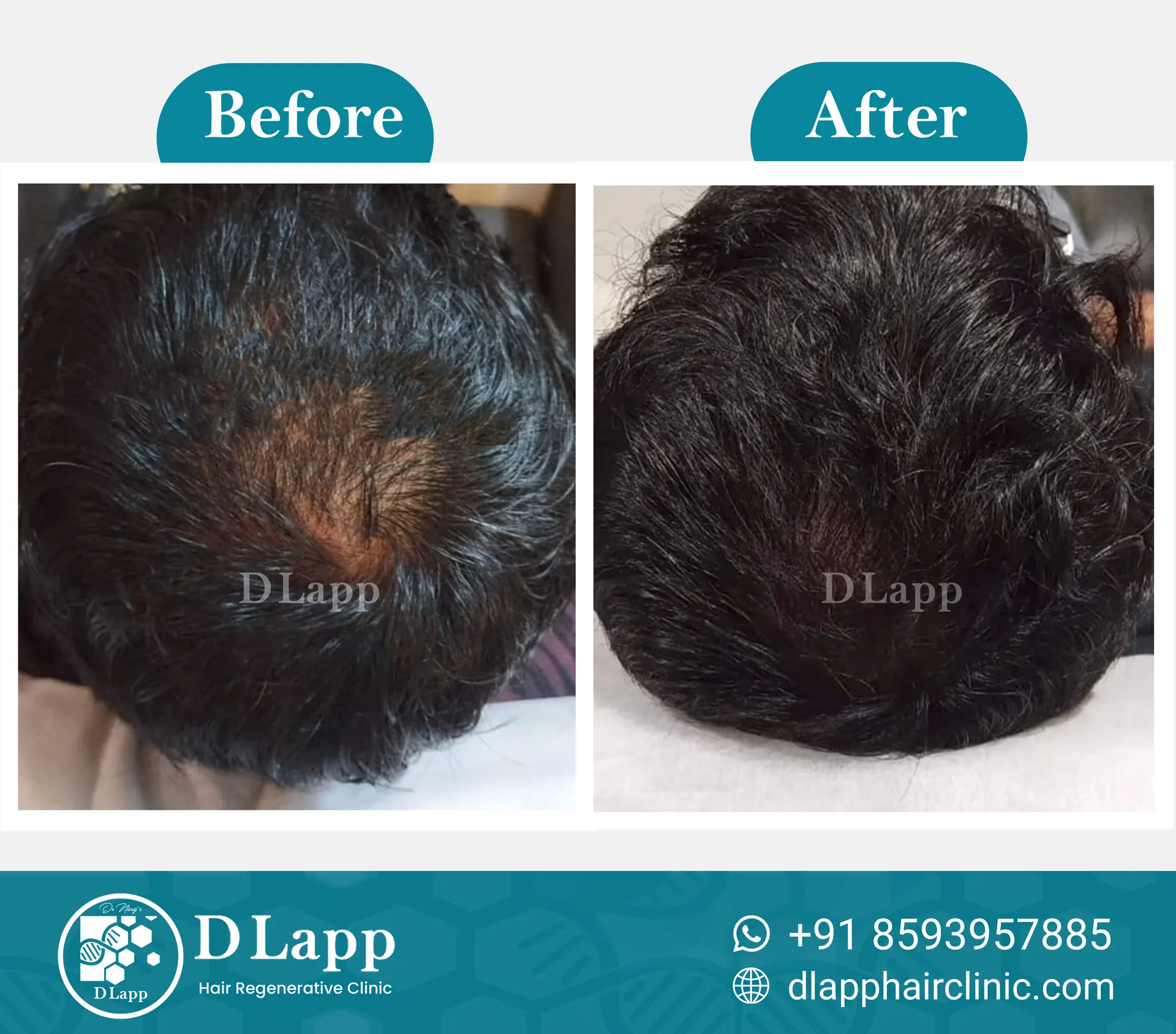 Before/After Medical Image