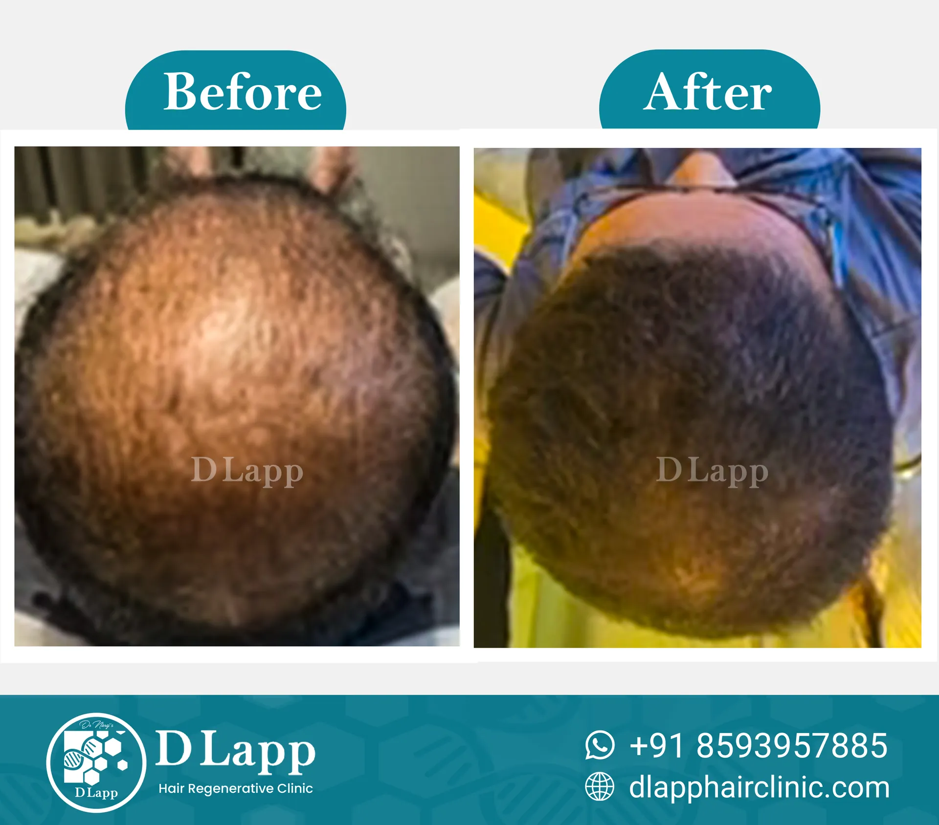 Before/After Medical Image