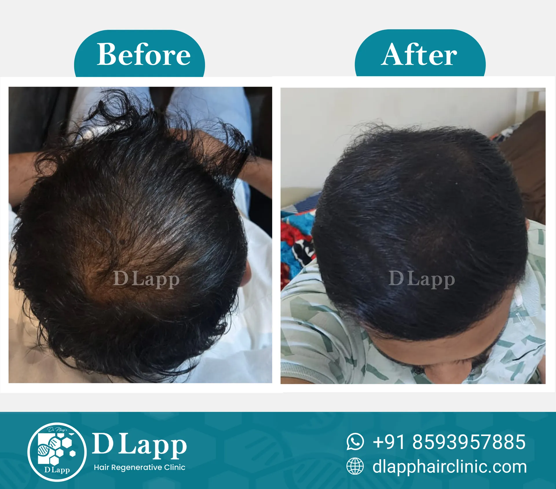 Before/After Medical Image