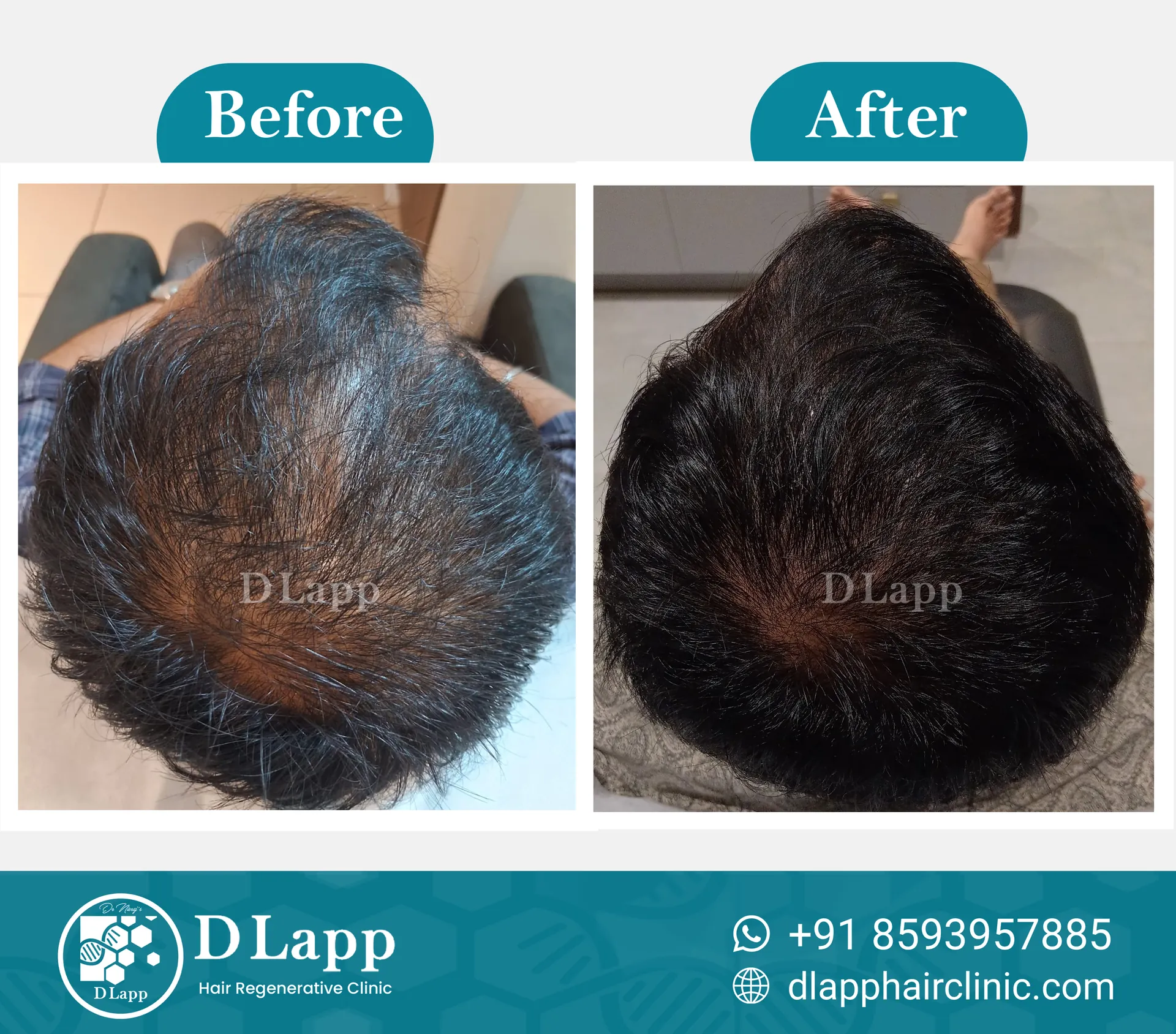 Before/After Medical Image