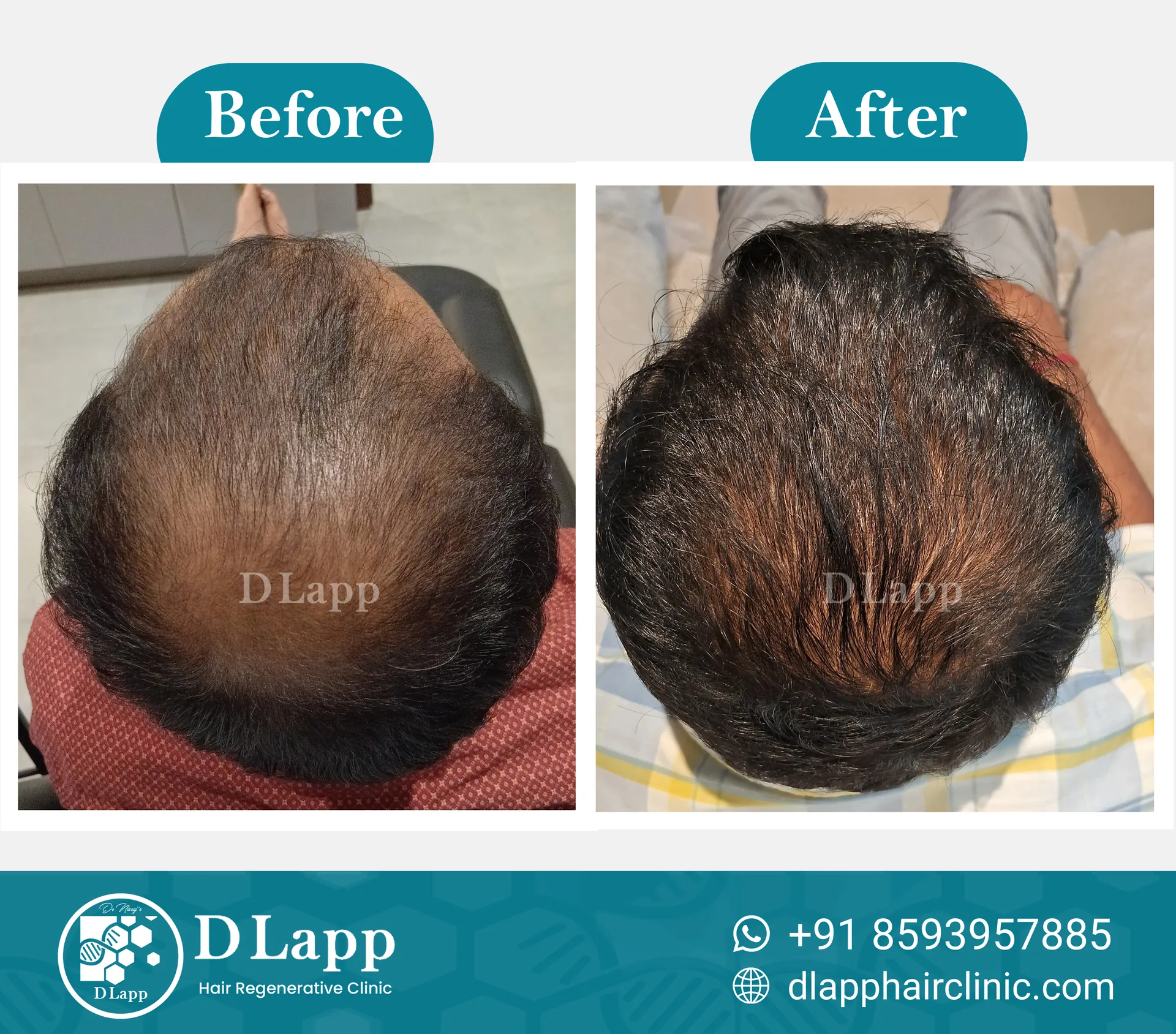 Before/After Medical Image