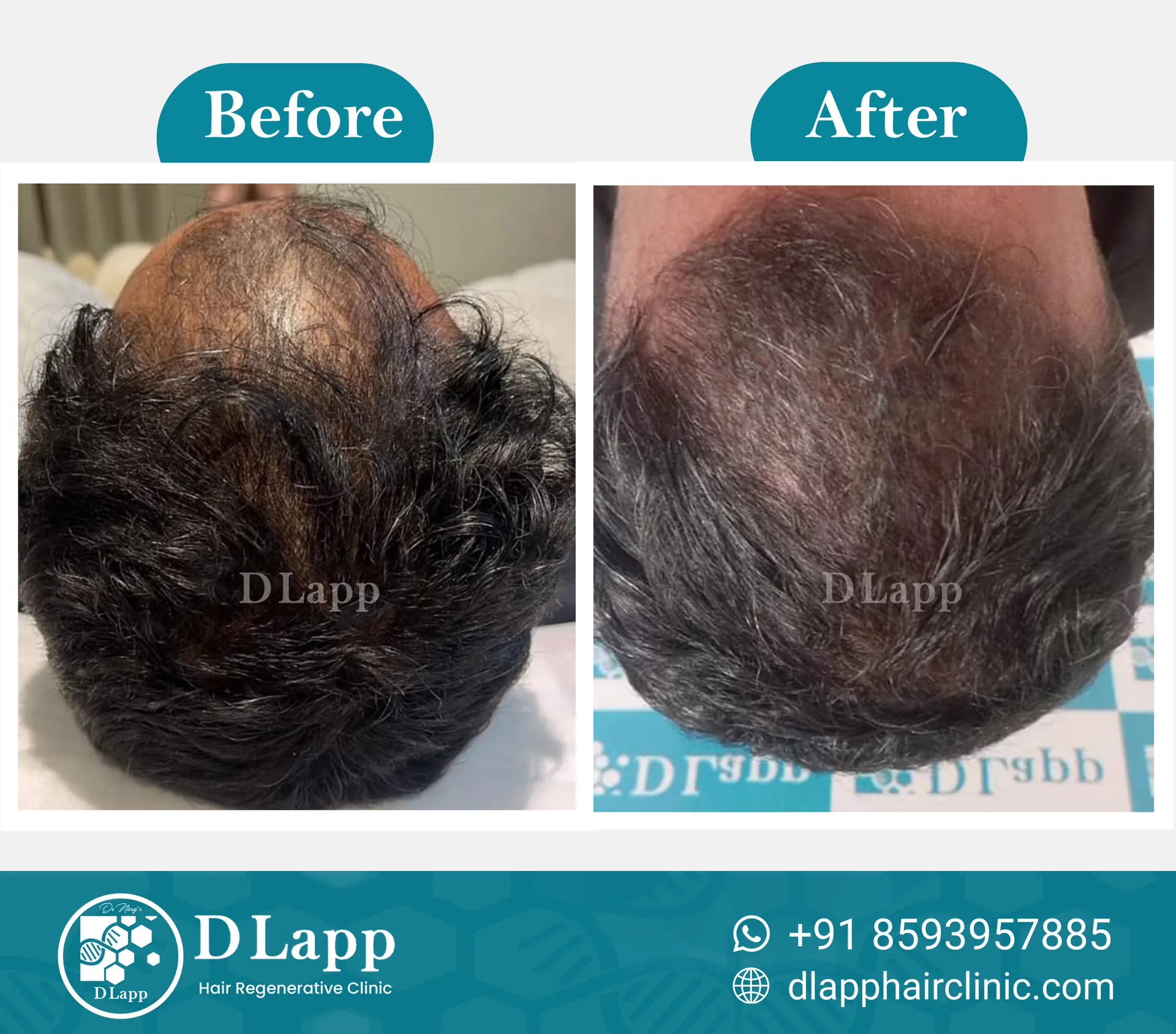 Before/After Medical Image