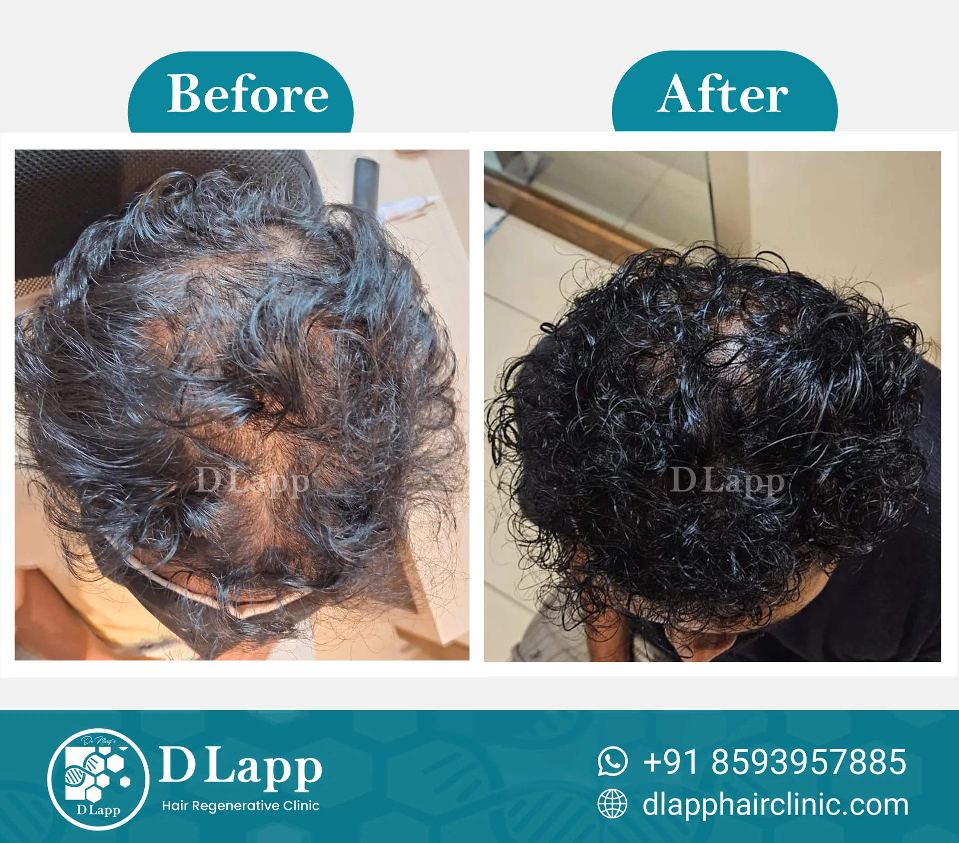 Before/After Medical Image
