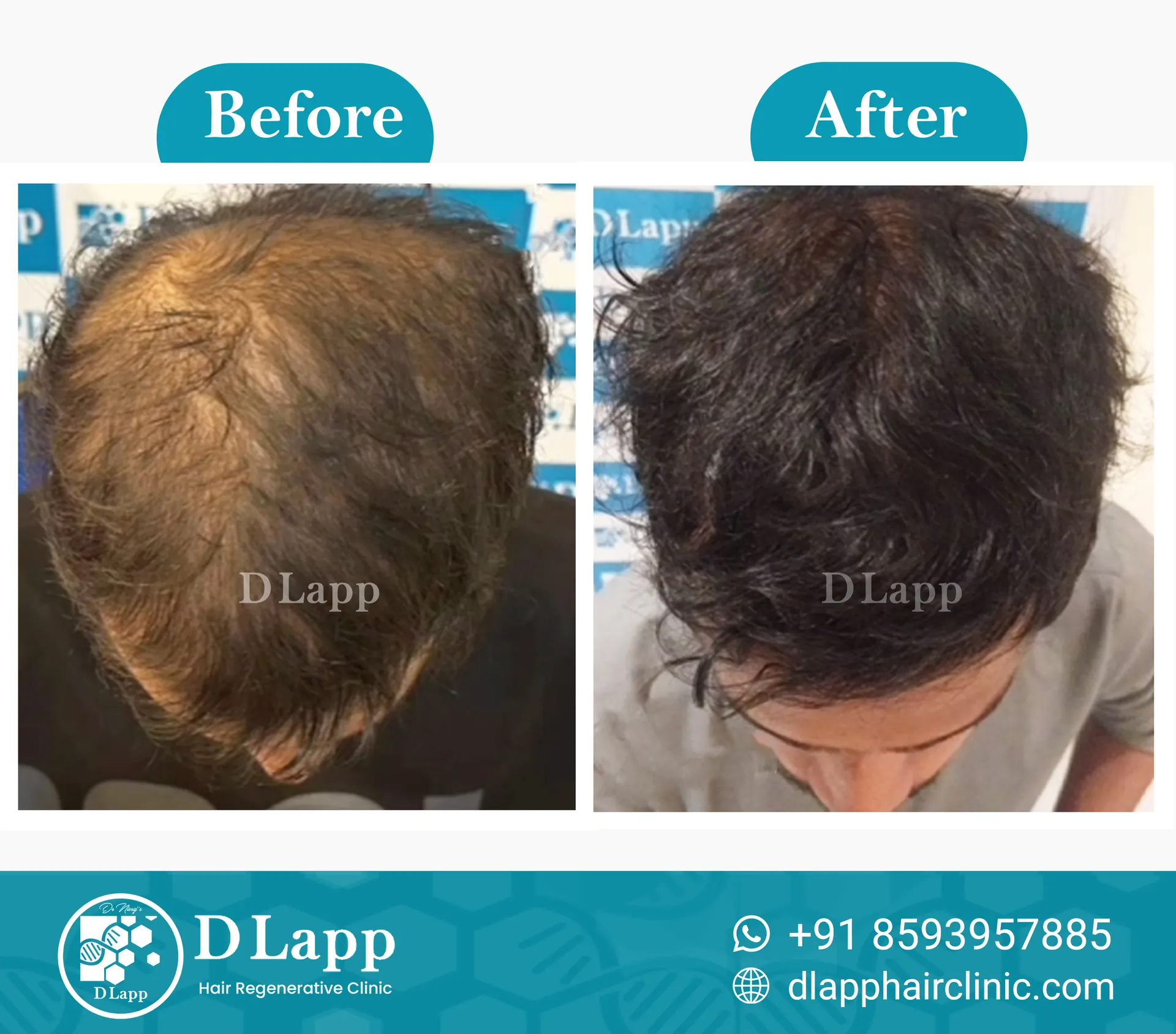 Before/After Medical Image