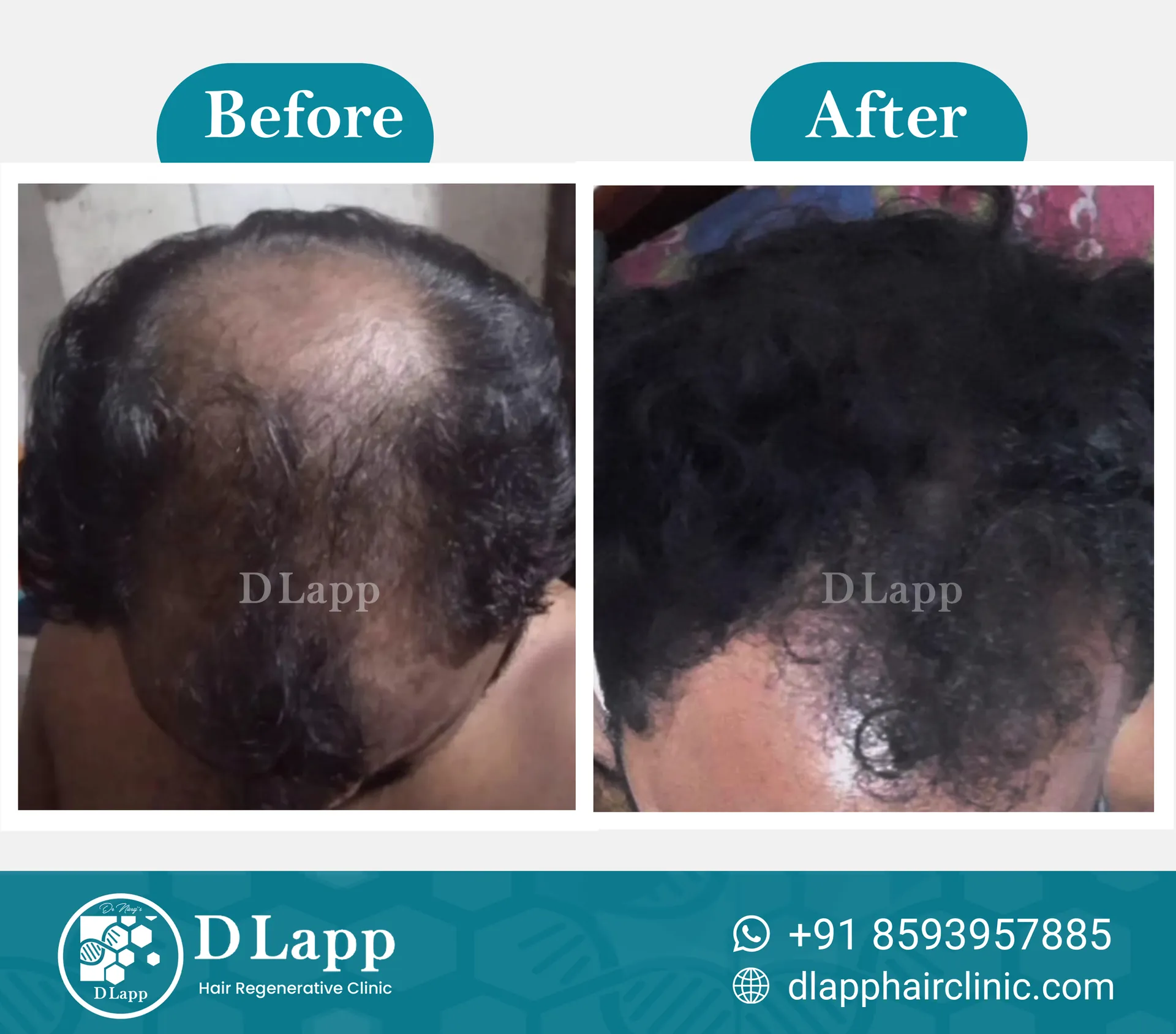 Before/After Medical Image