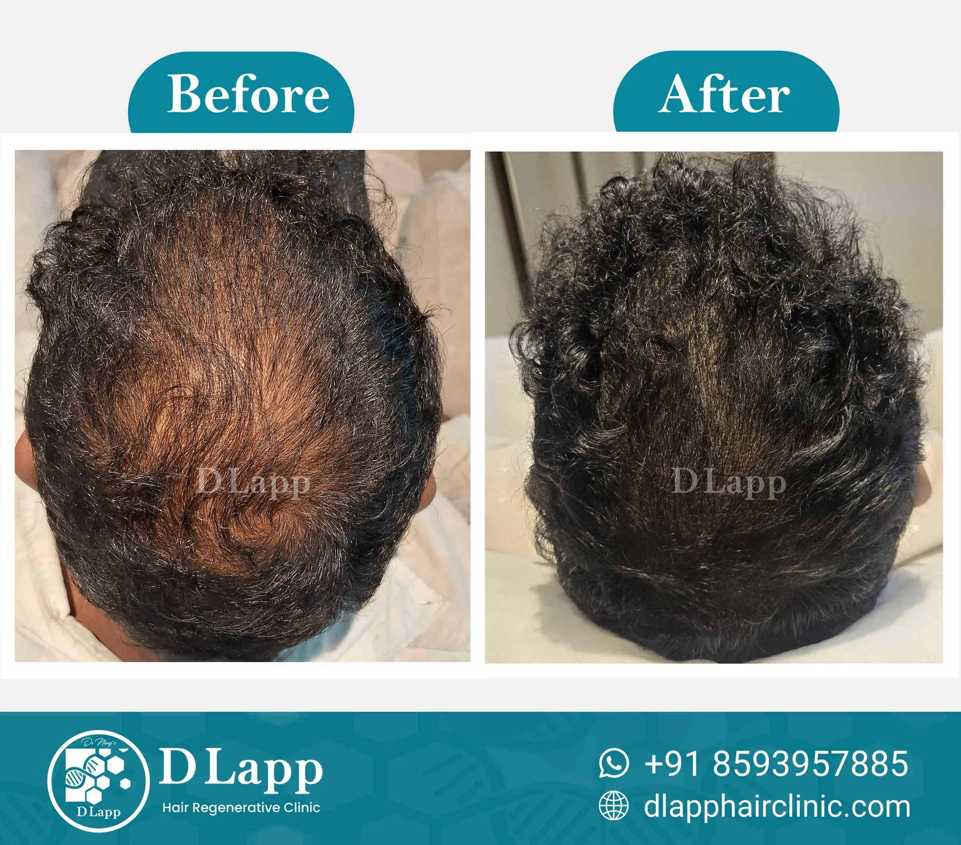 Before/After Medical Image