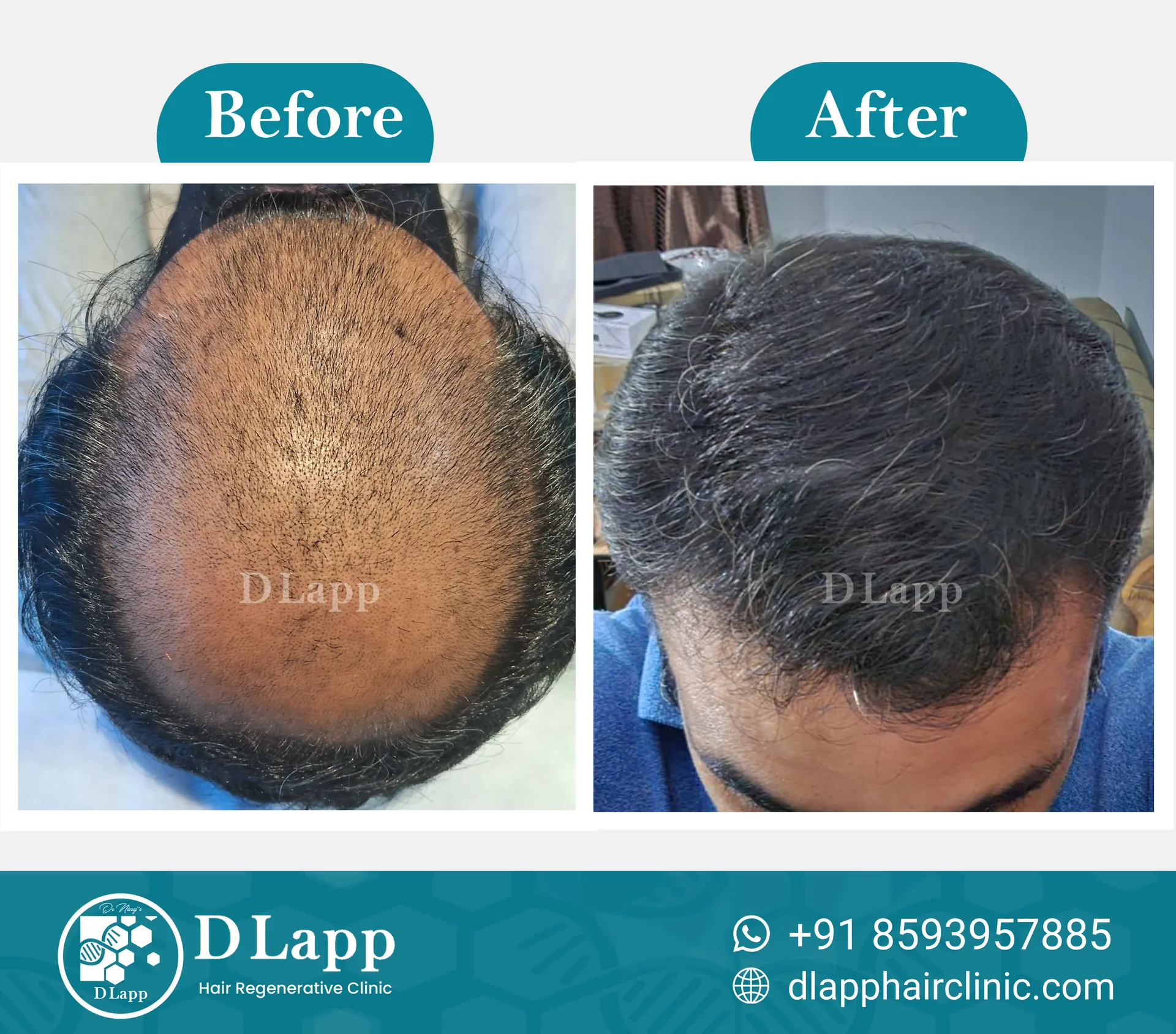 Before/After Medical Image