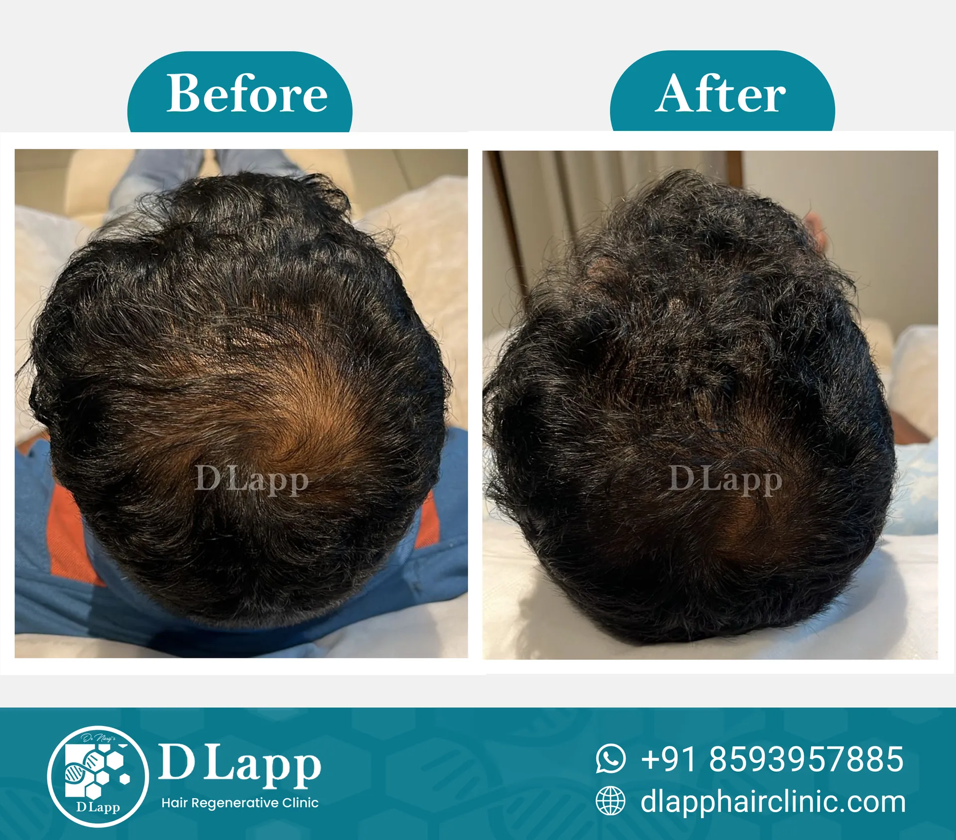 Before/After Medical Image