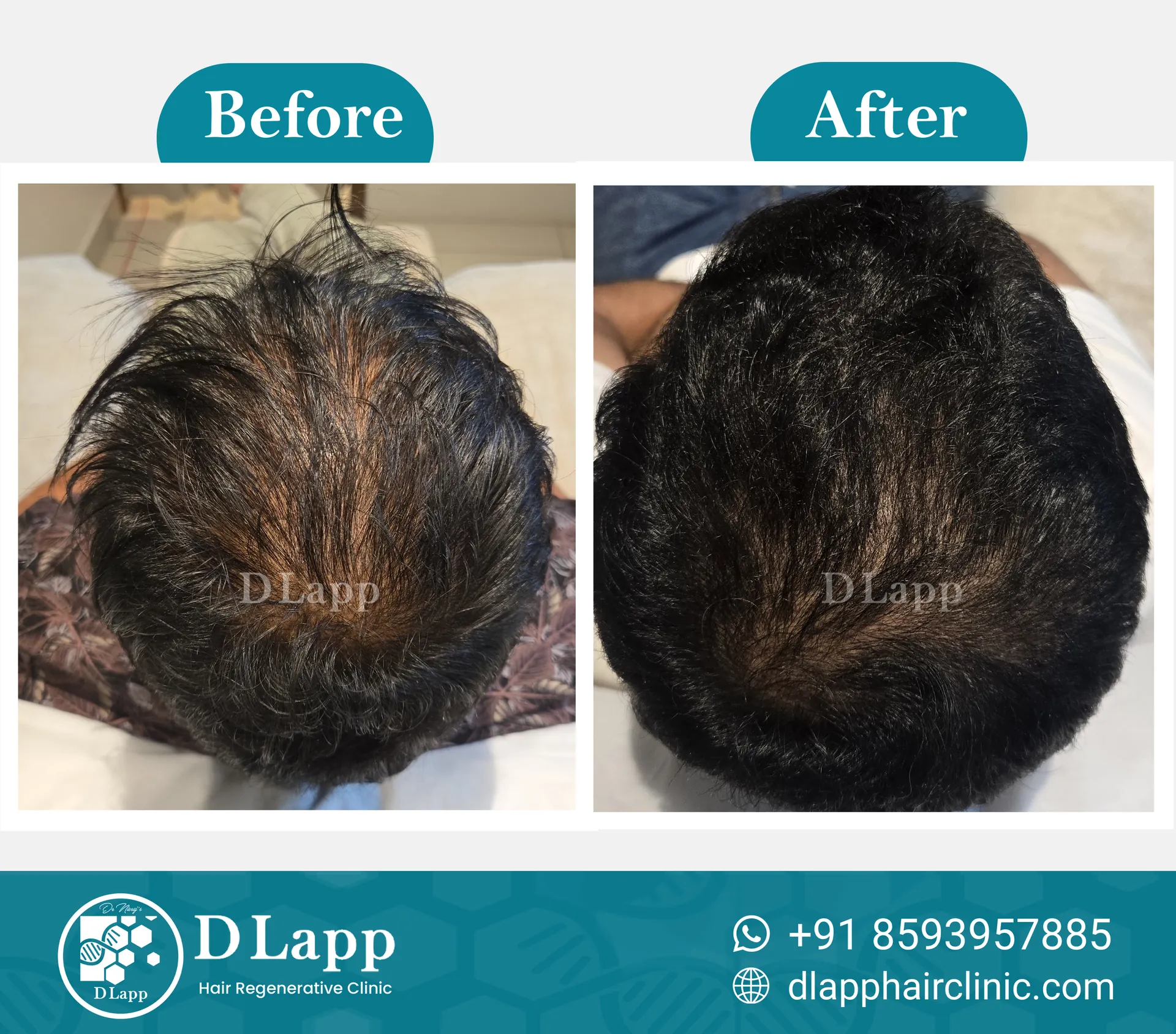 Before/After Medical Image