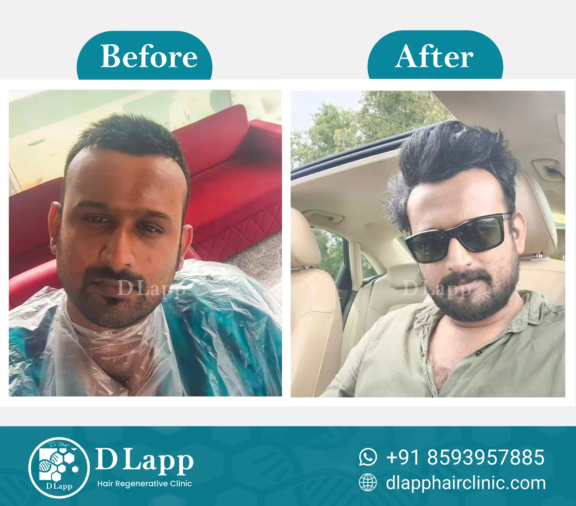 Before/After Medical Image