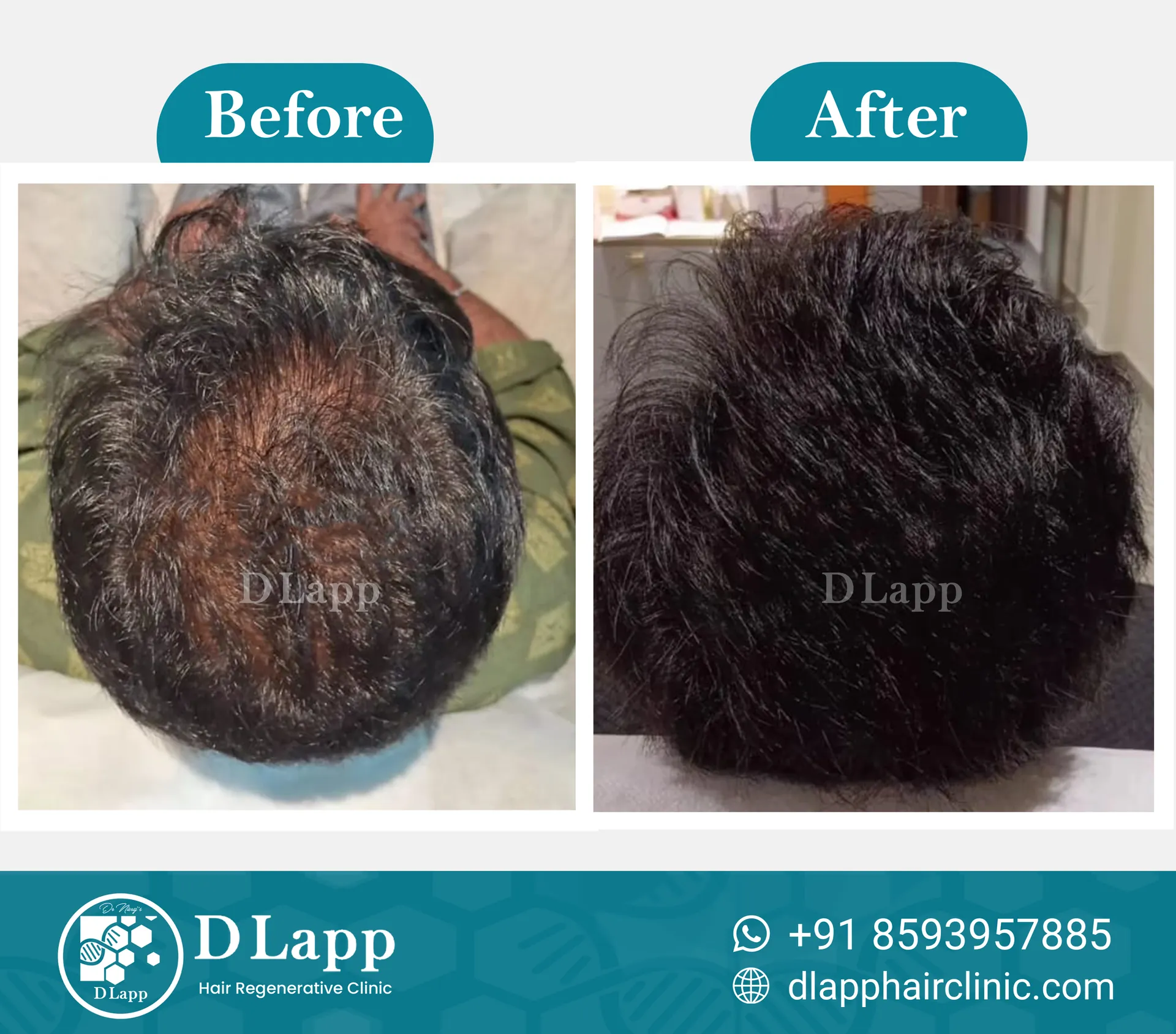 Before/After Medical Image