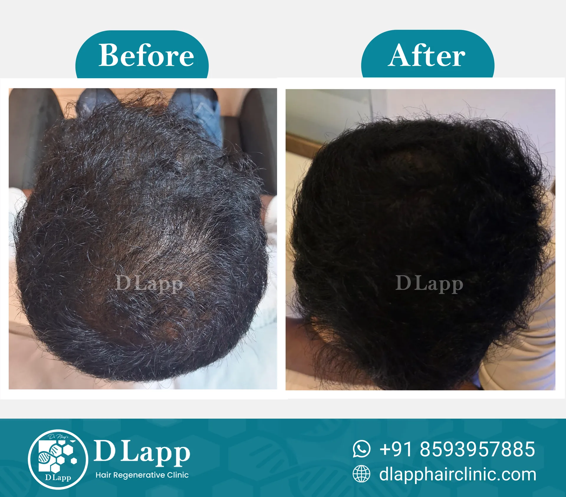 Before/After Medical Image