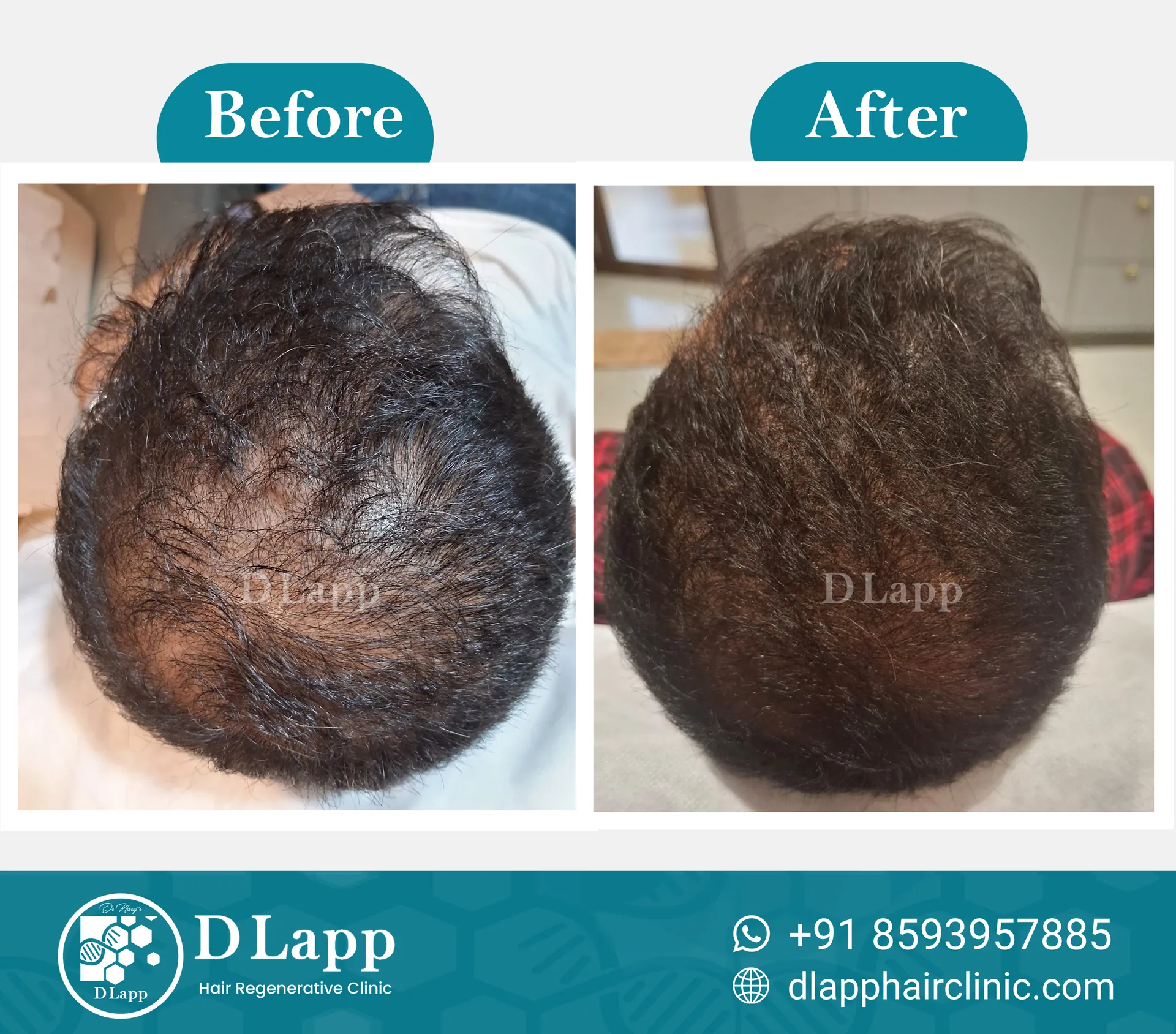 Before/After Medical Image