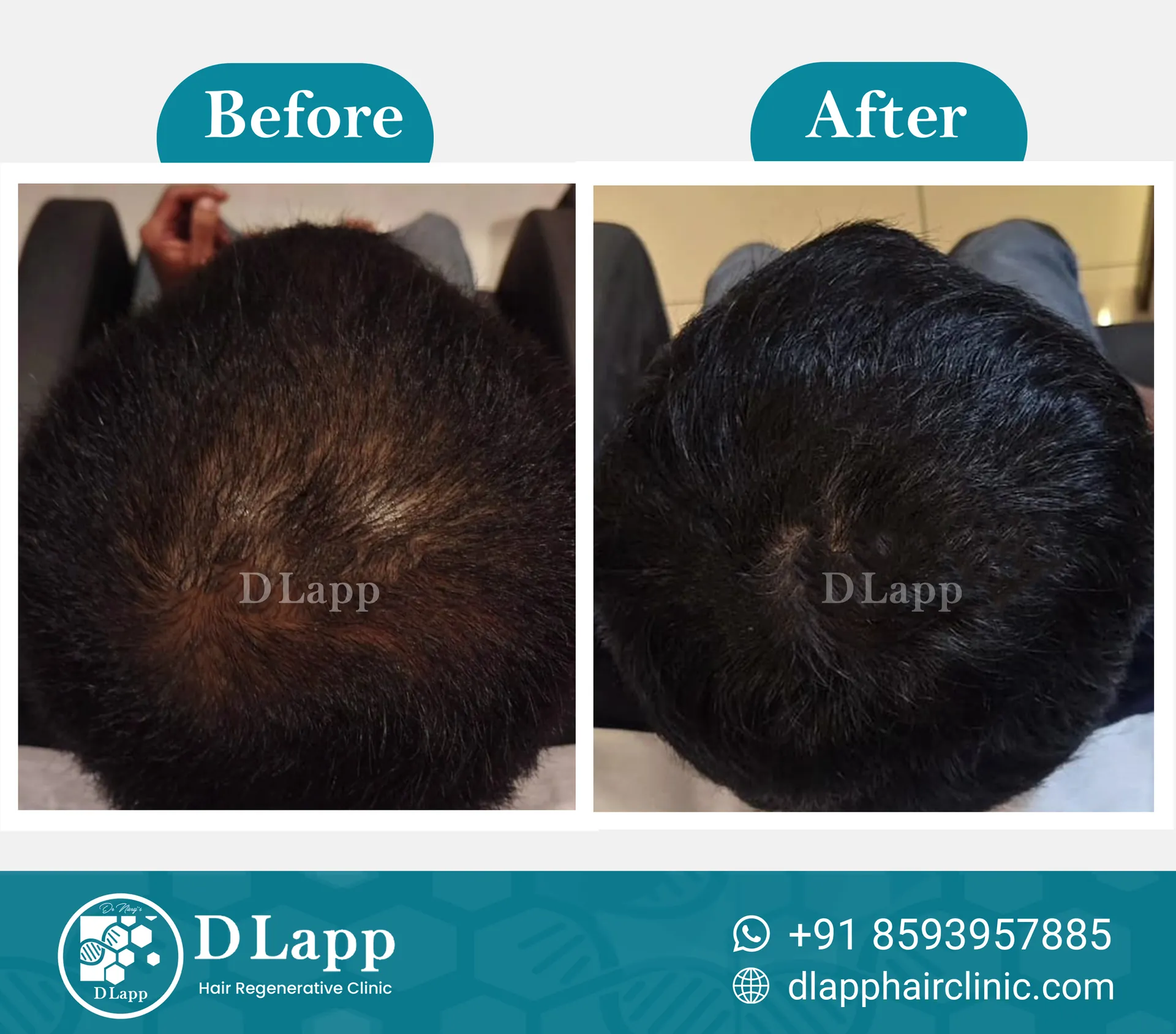 Before/After Medical Image