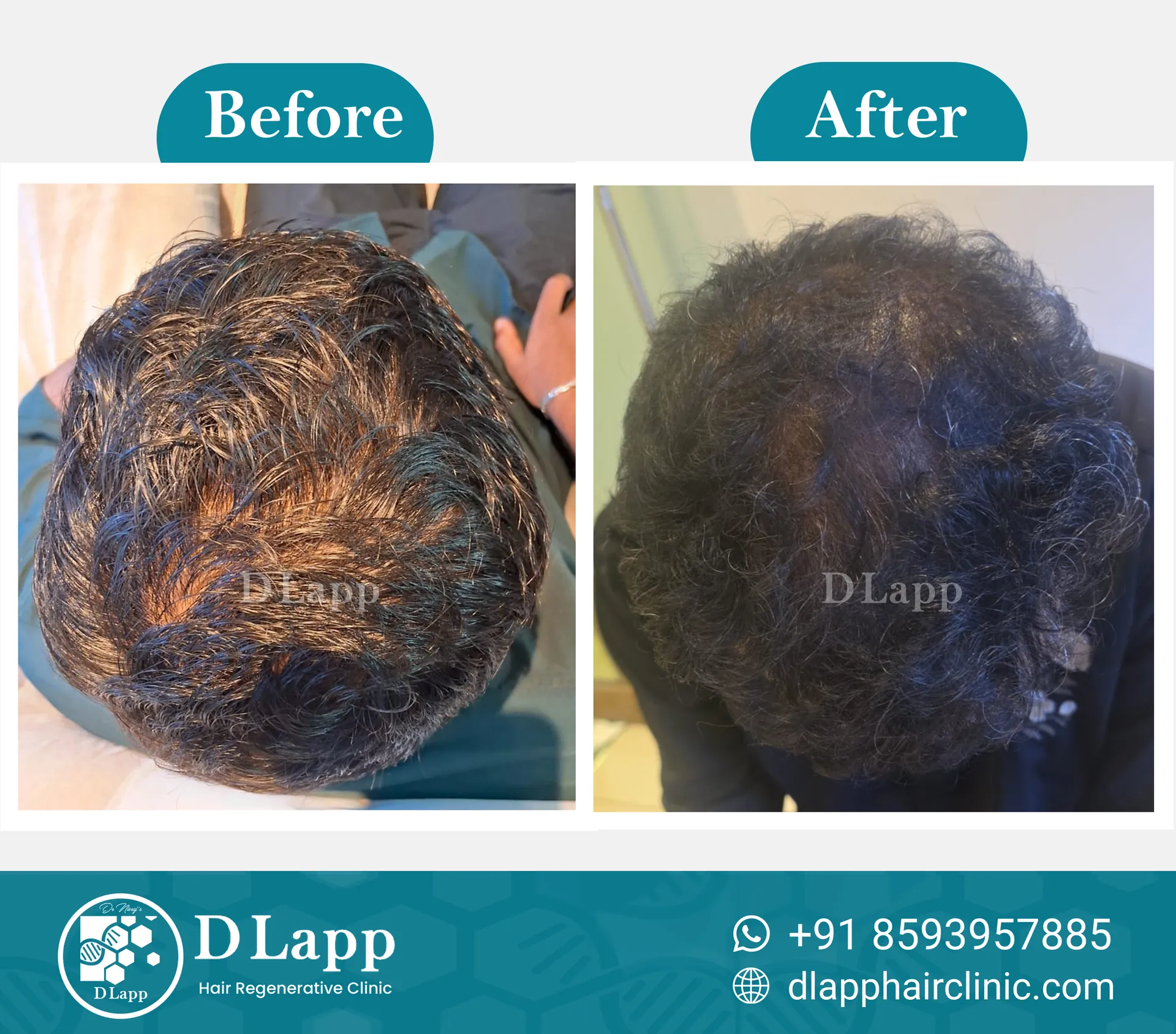 Before/After Medical Image
