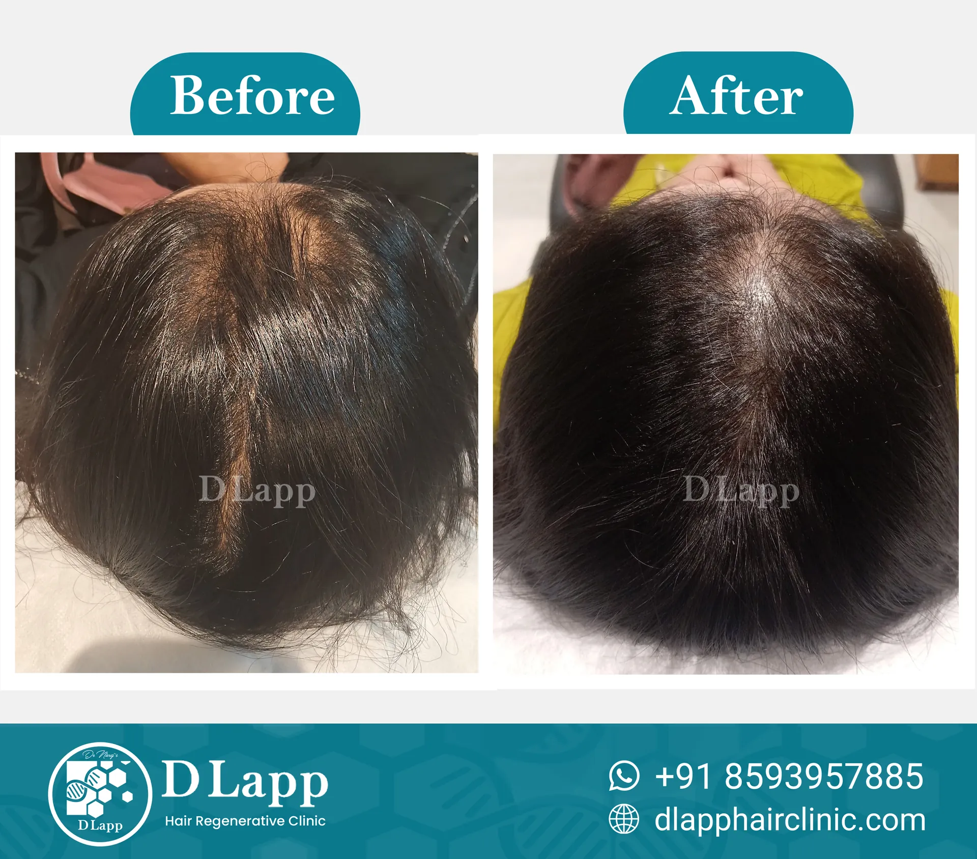 Before/After Medical Image
