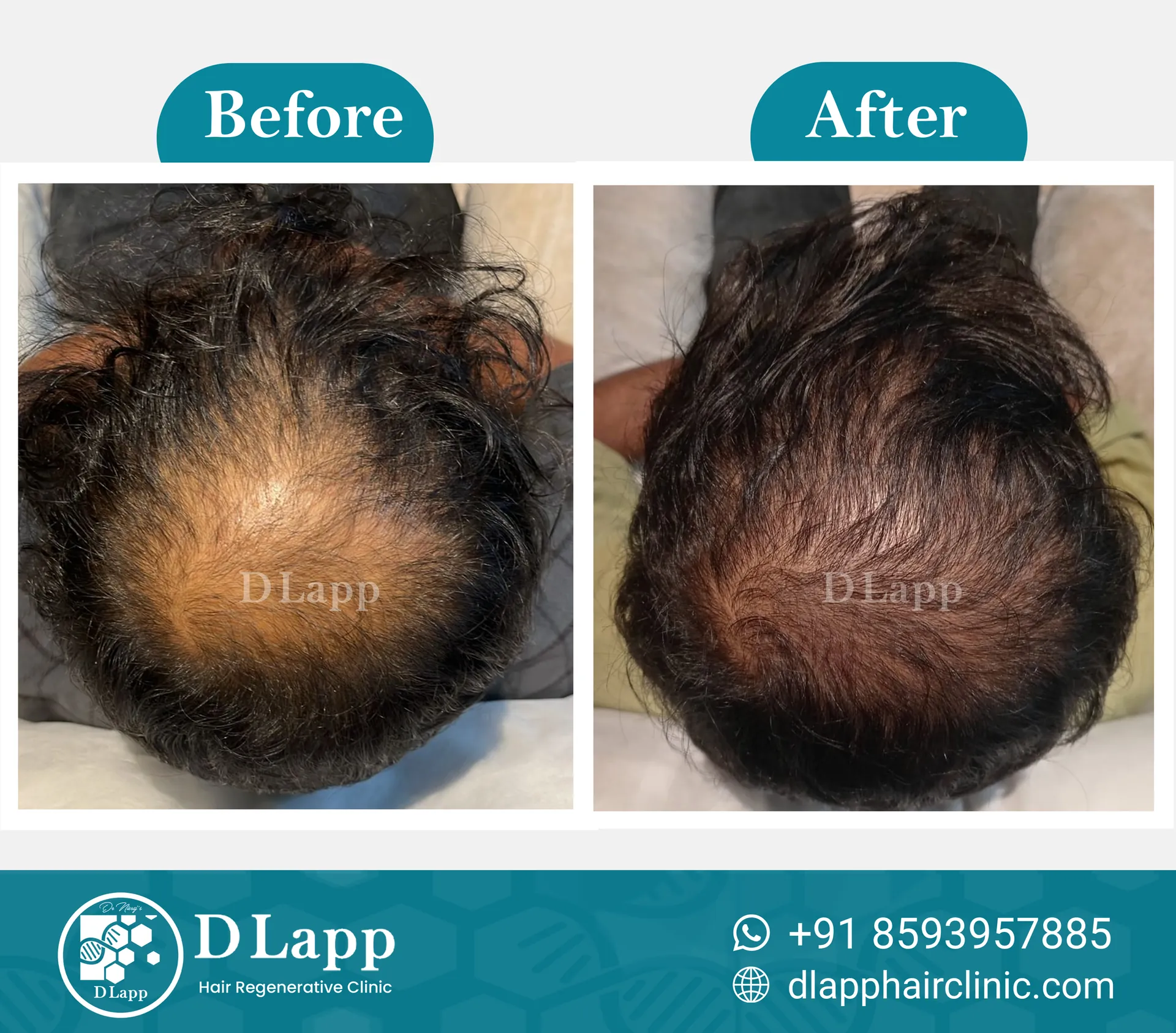 Before/After Medical Image