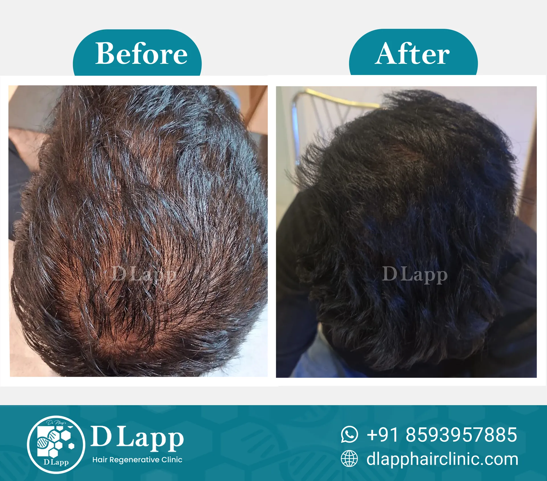 Before/After Medical Image