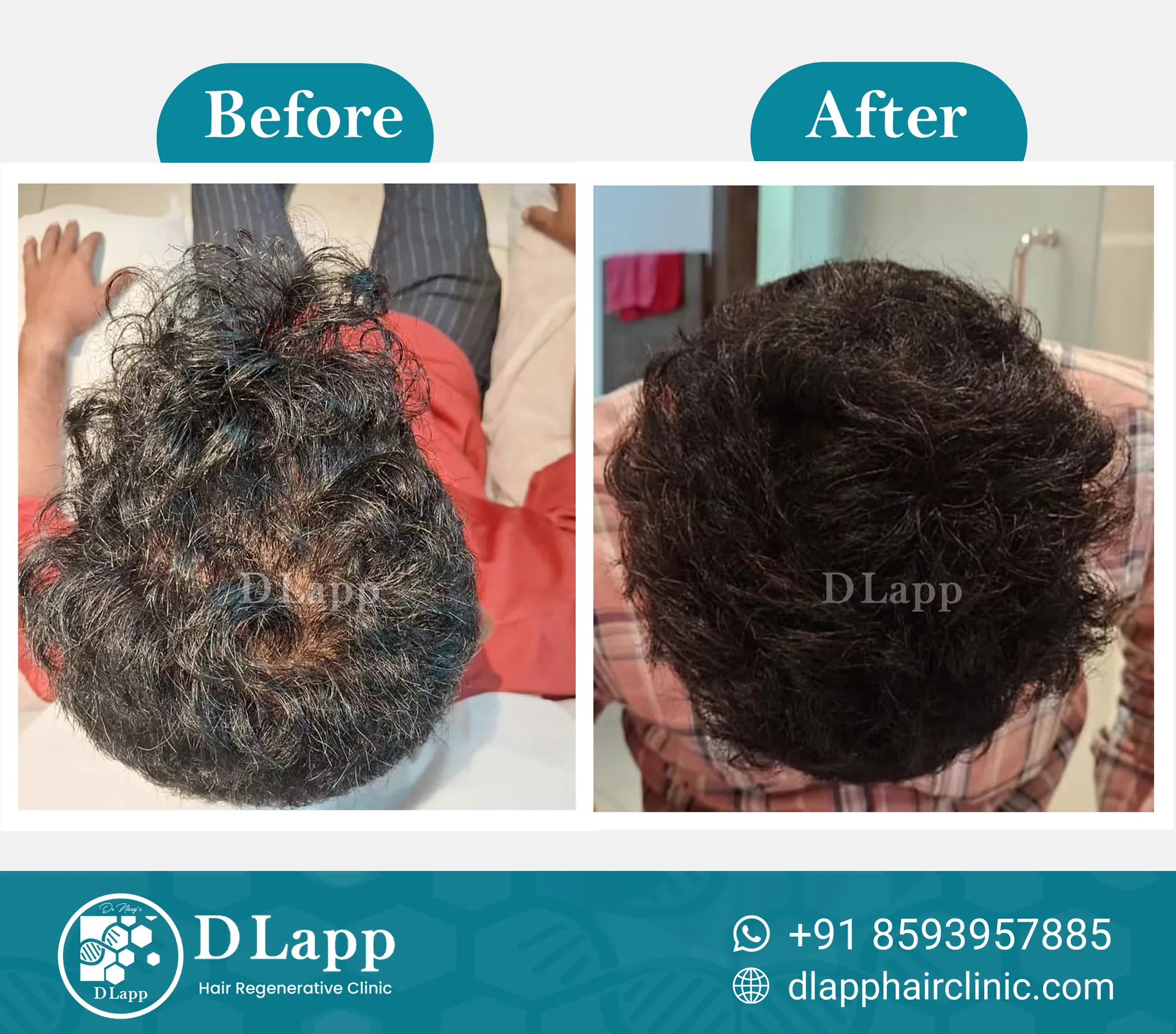 Before/After Medical Image