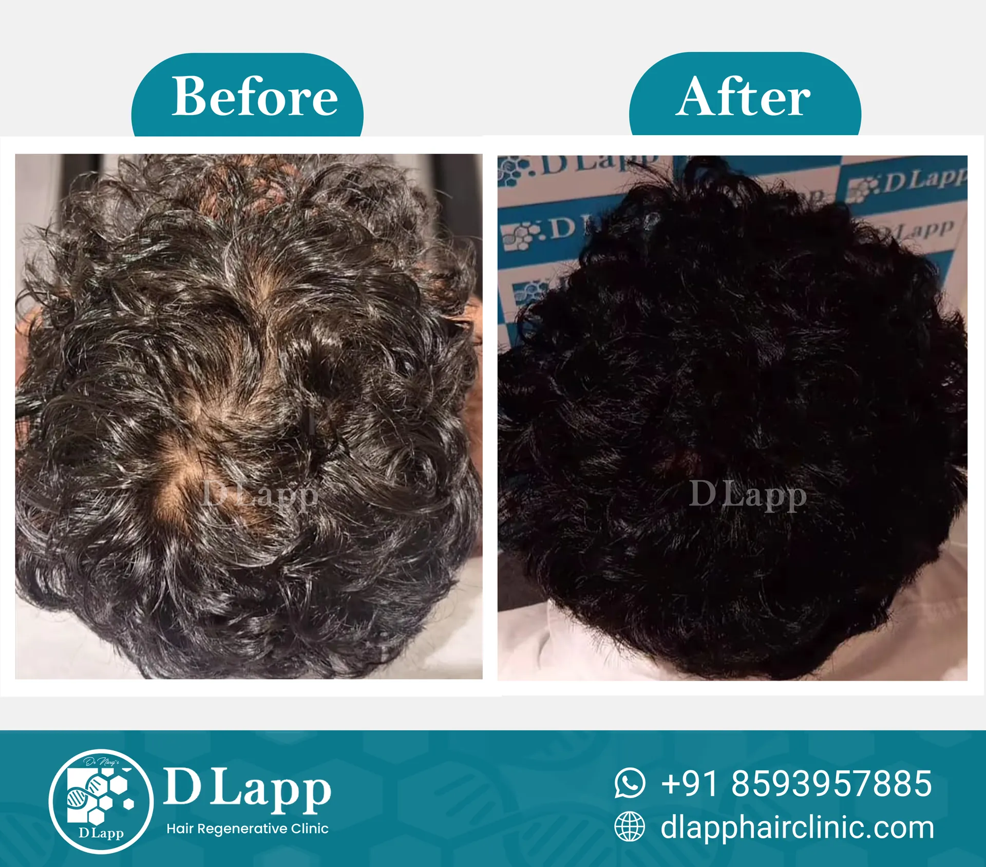 Before/After Medical Image