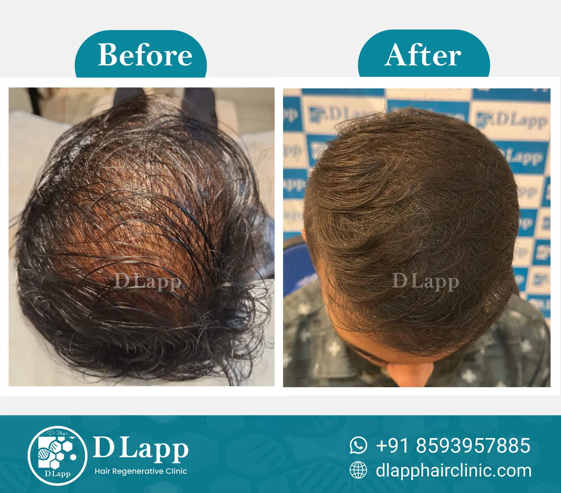 Before/After Medical Image