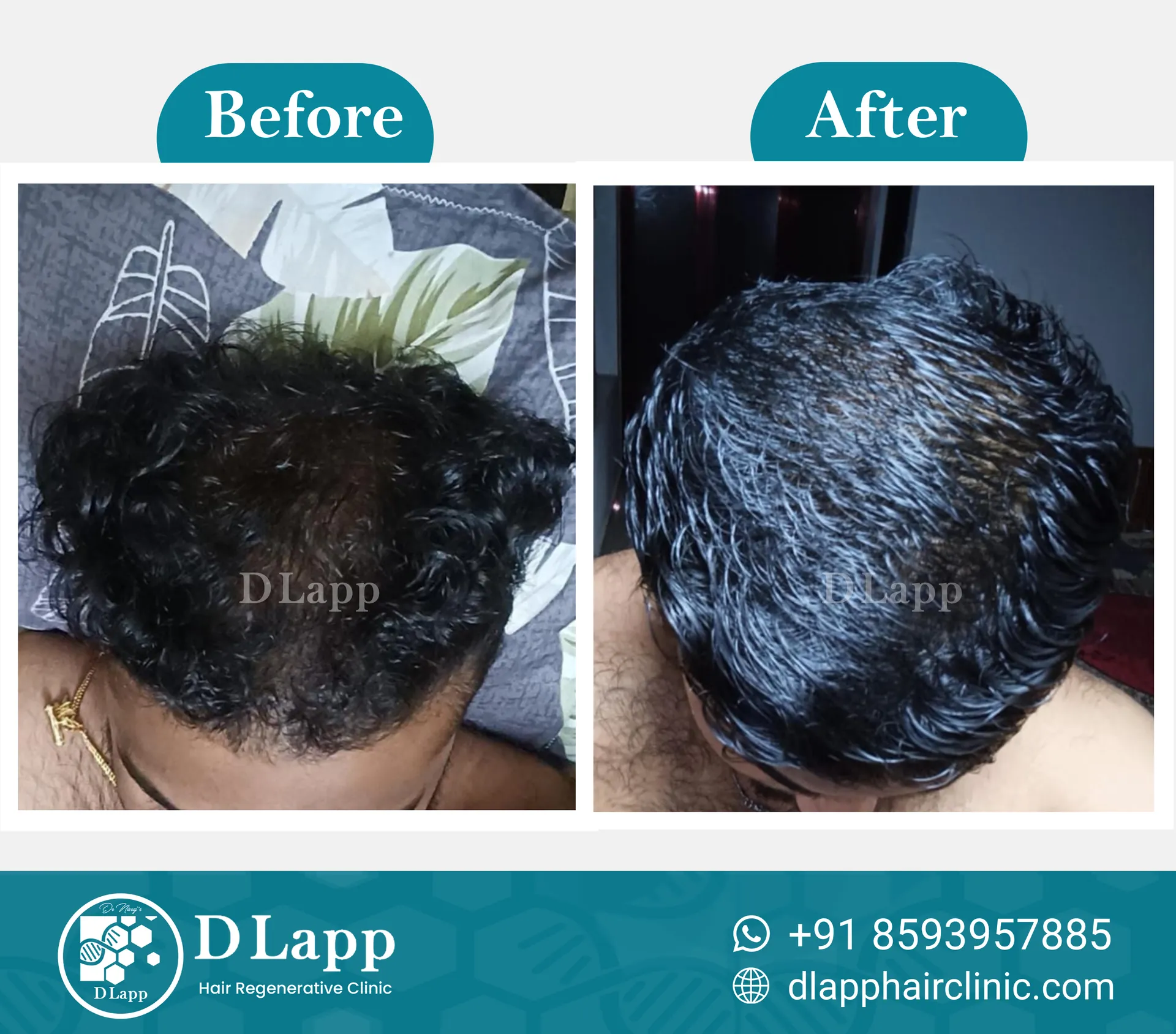 Before/After Medical Image