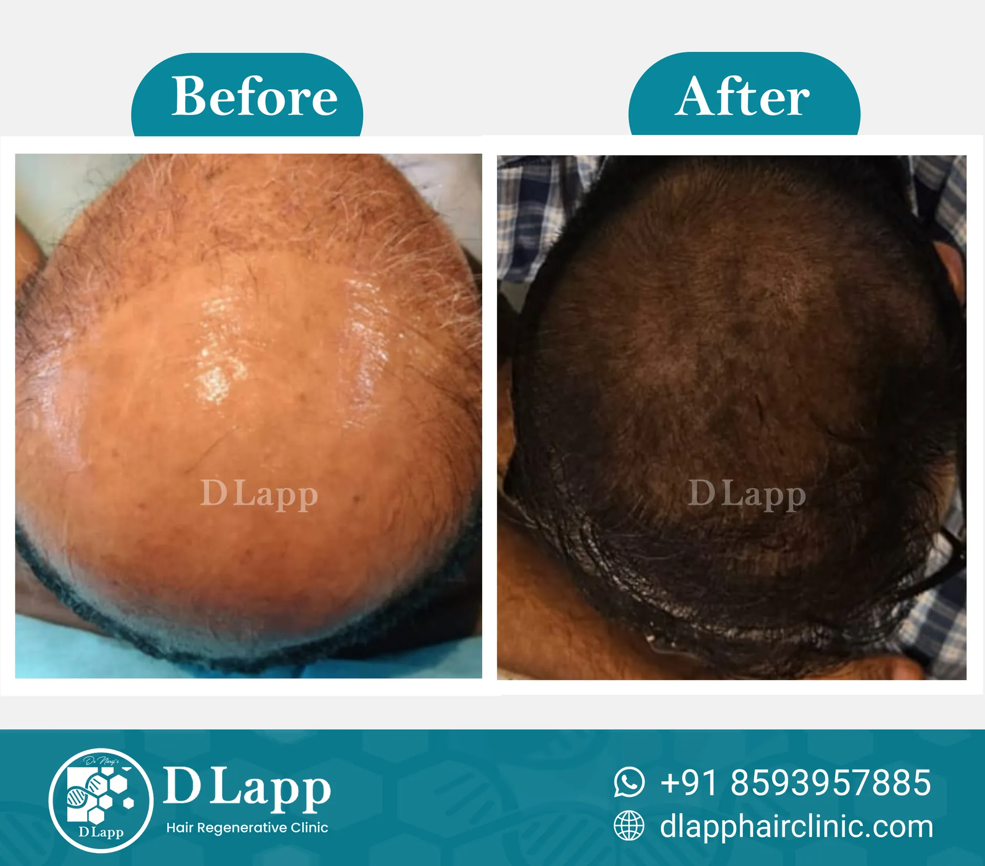 Before/After Medical Image