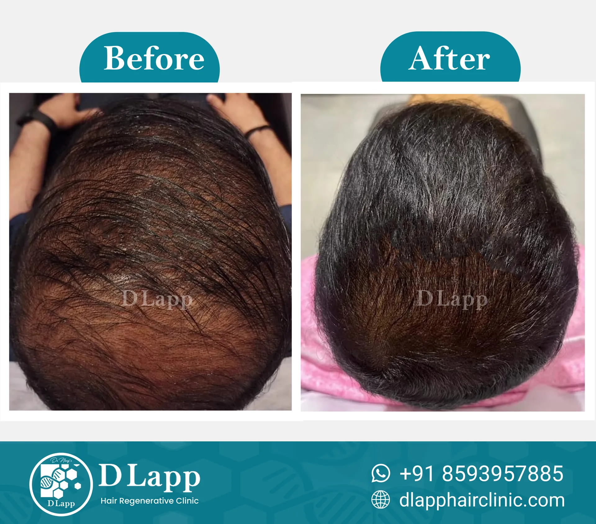 Before/After Medical Image