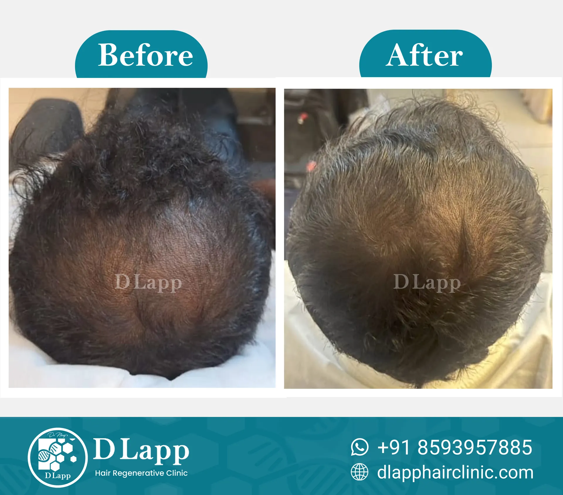 Before/After Medical Image