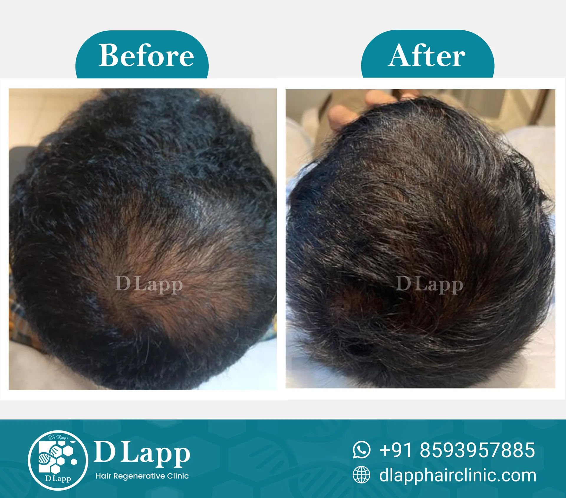 Before/After Medical Image