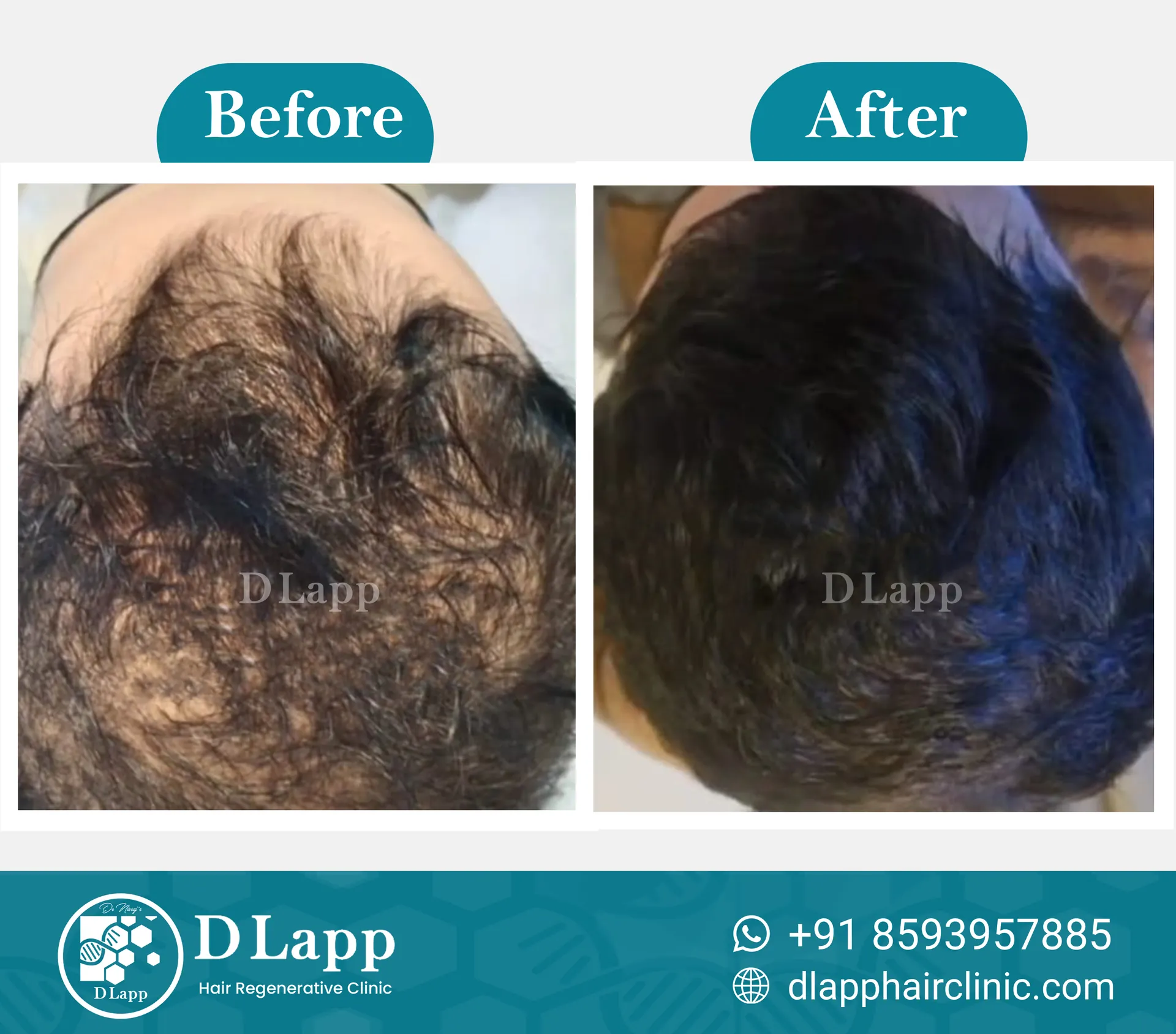Before/After Medical Image