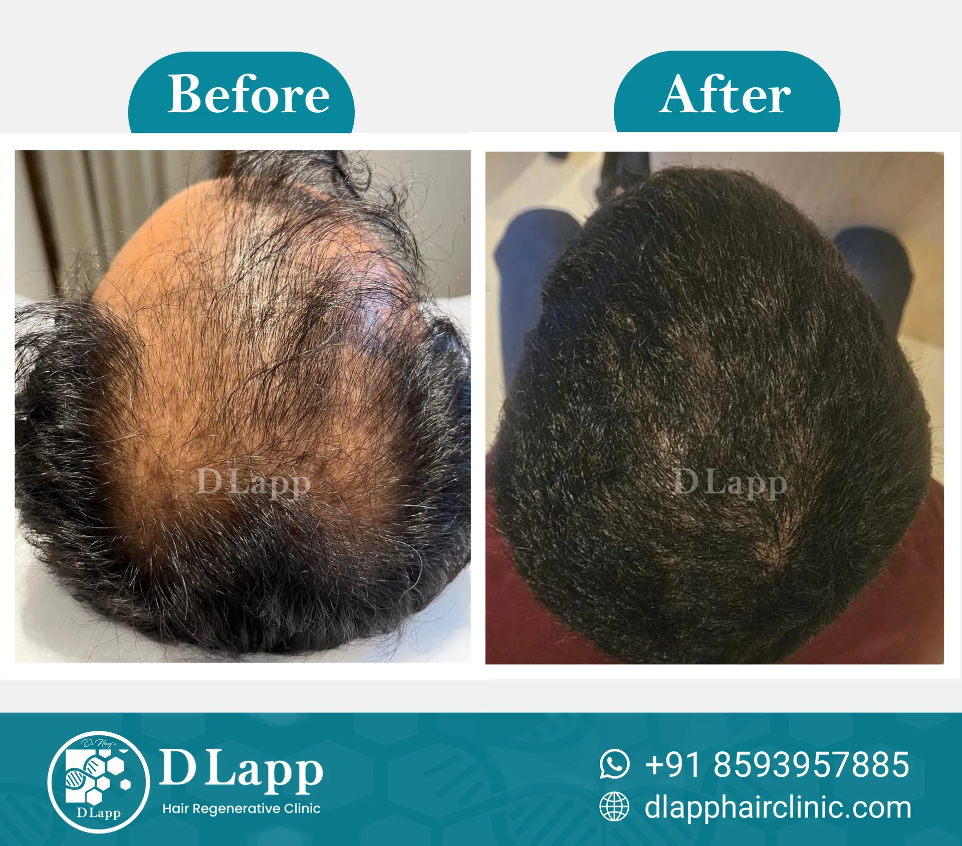 Before/After Medical Image