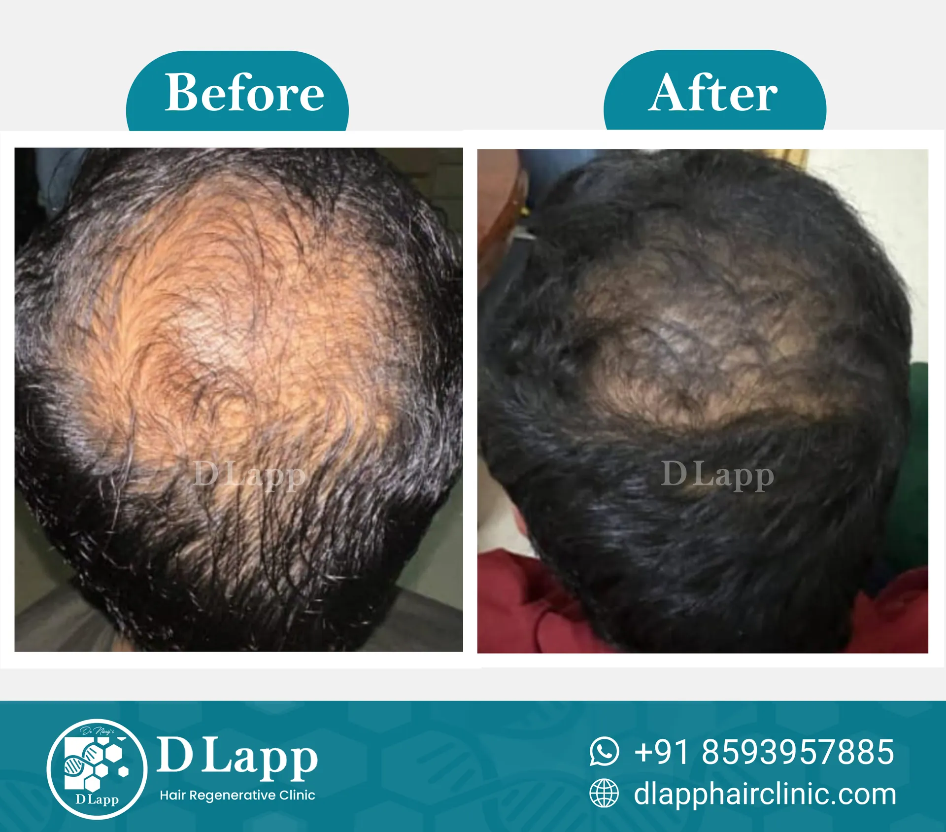 Before/After Medical Image