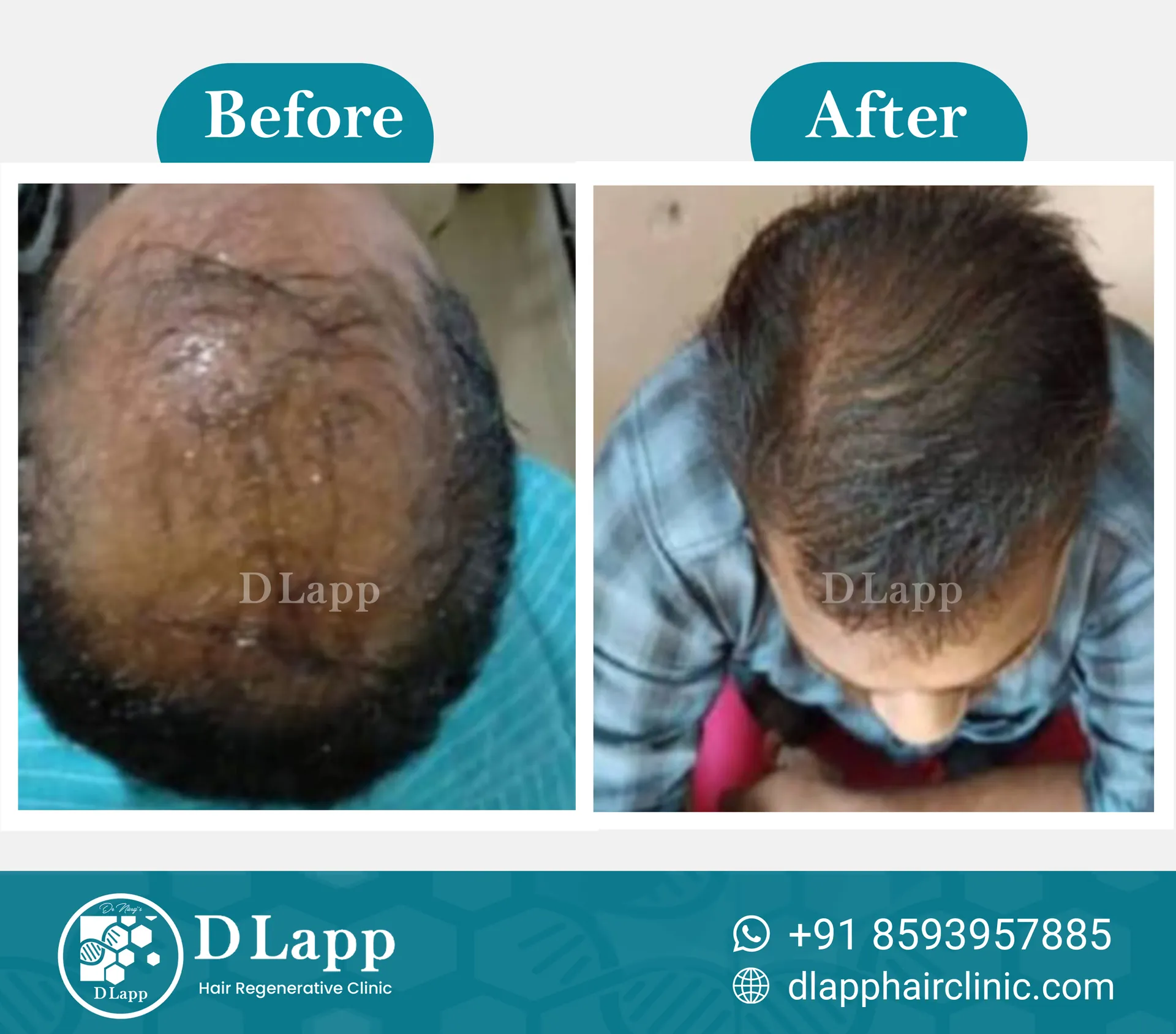 Before/After Medical Image