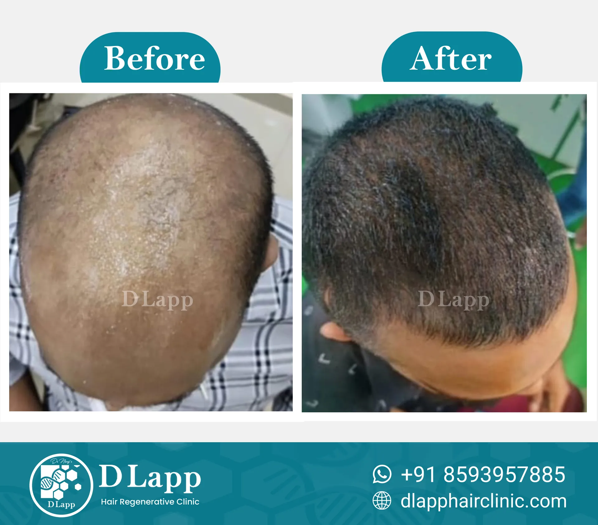 Before/After Medical Image