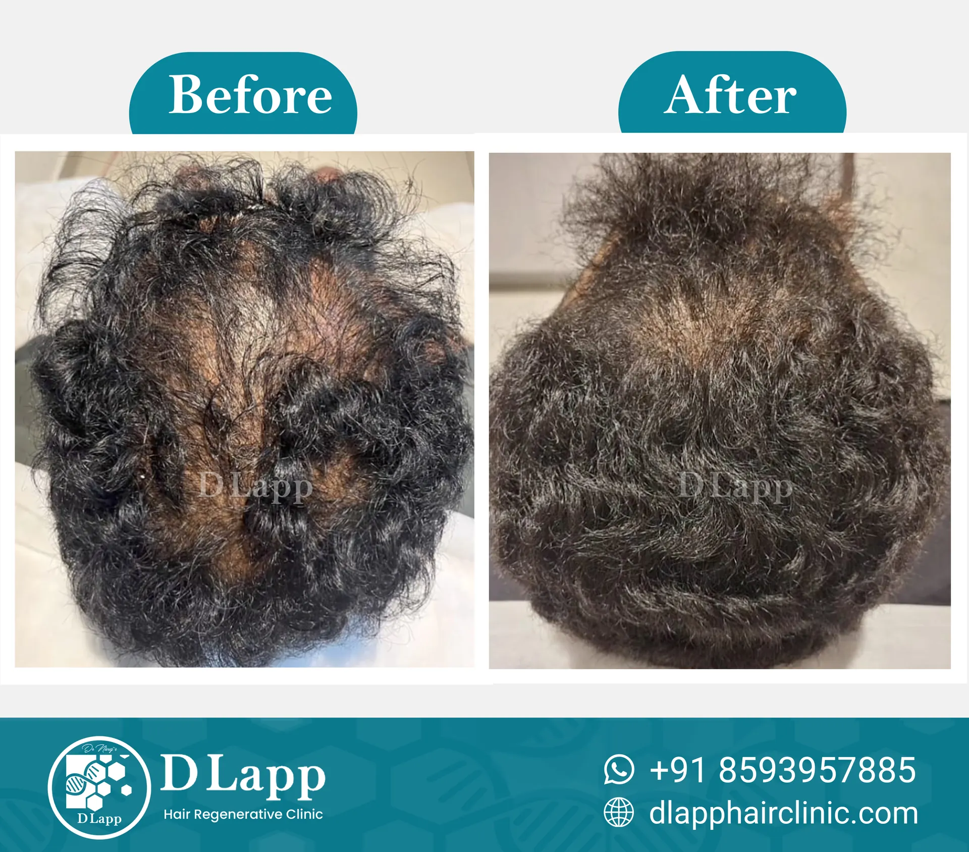 Before/After Medical Image