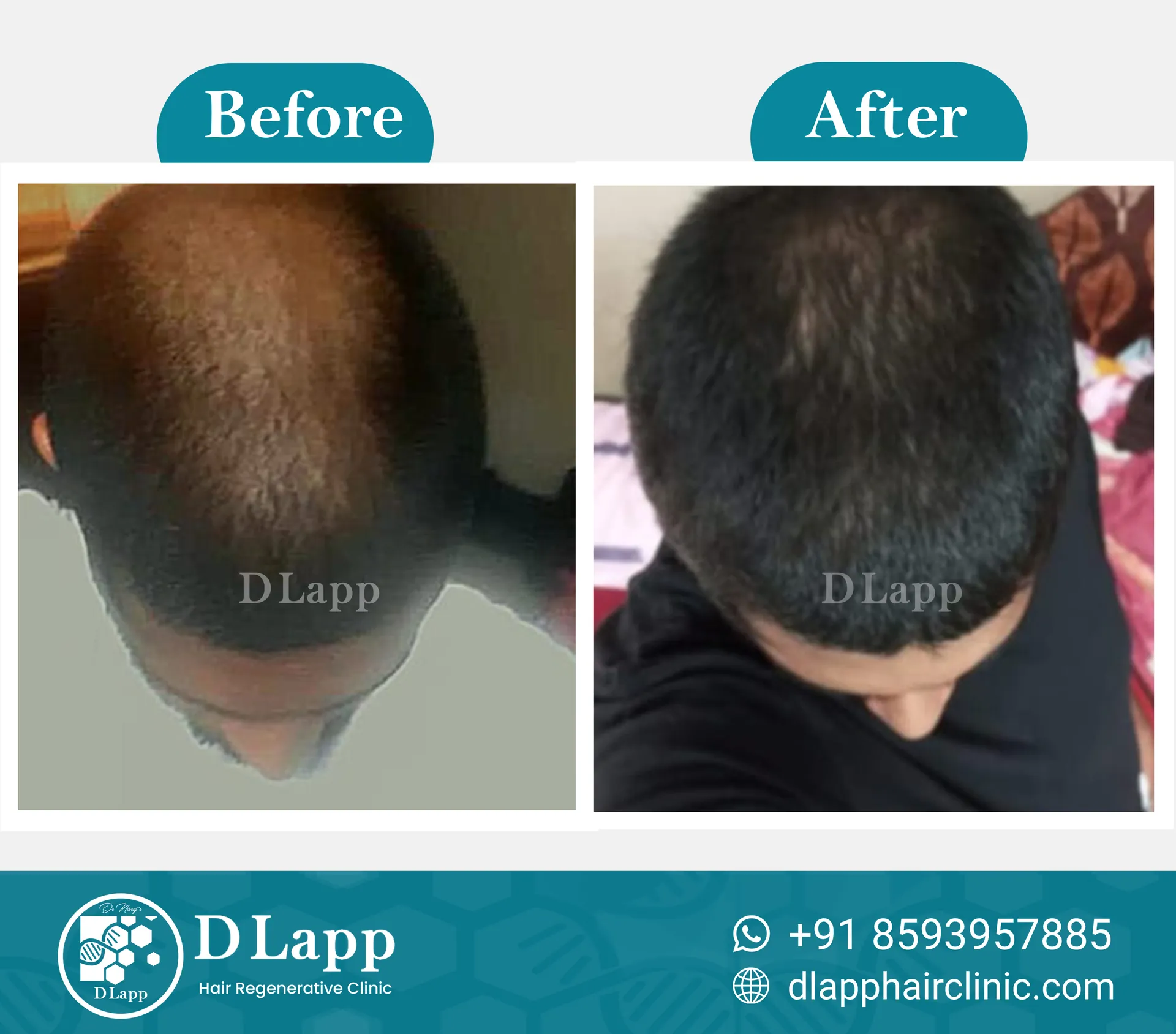Before/After Medical Image